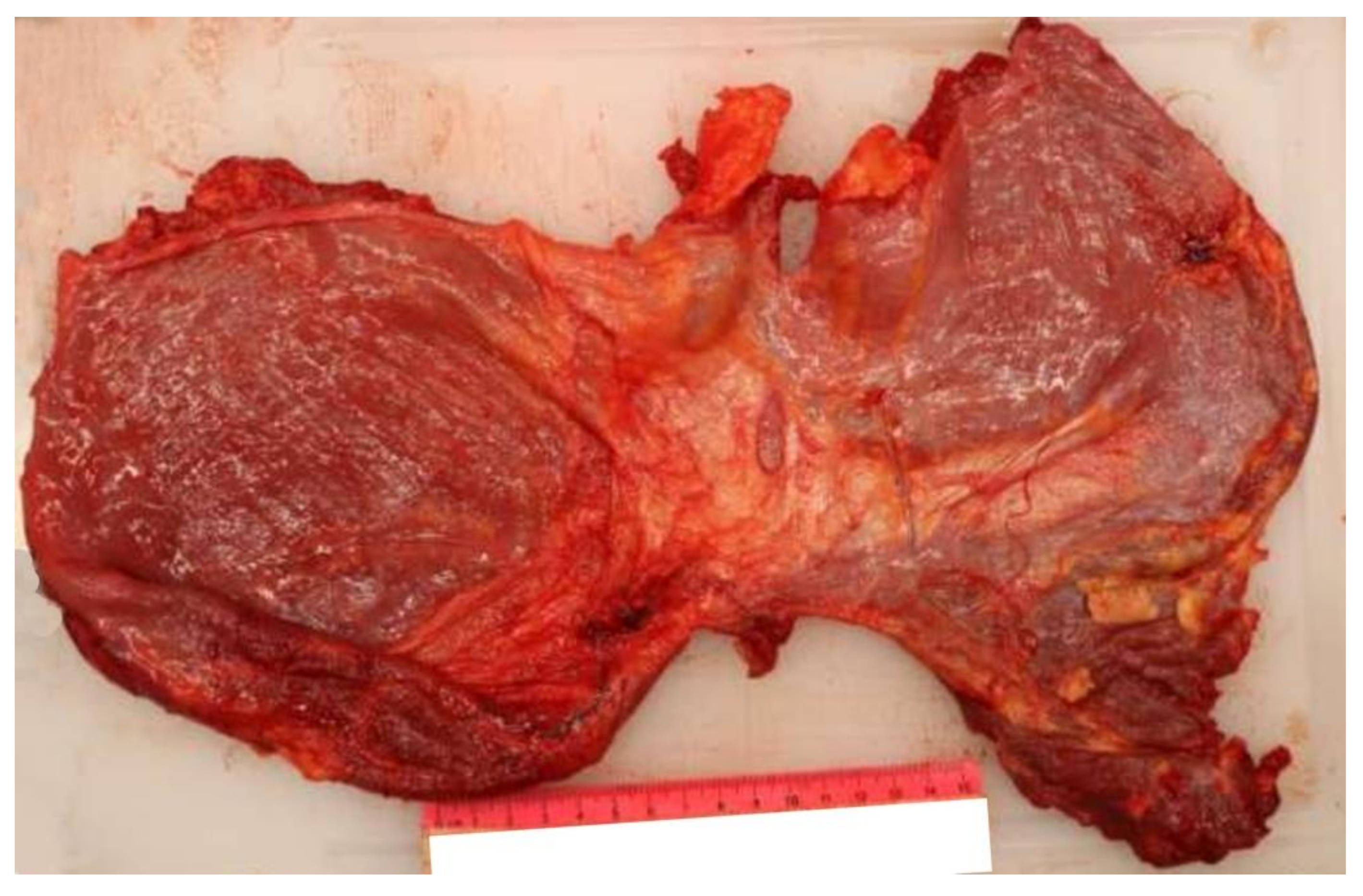 Diagnostics 12 00899 g004