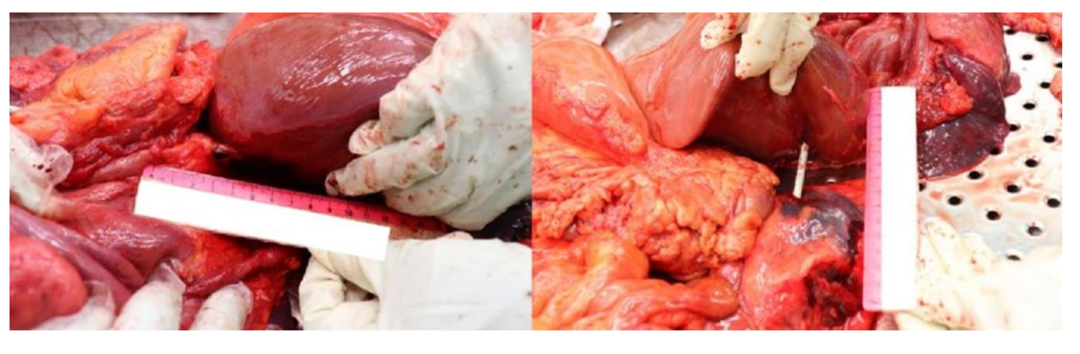 Diagnostics 12 00899 g005