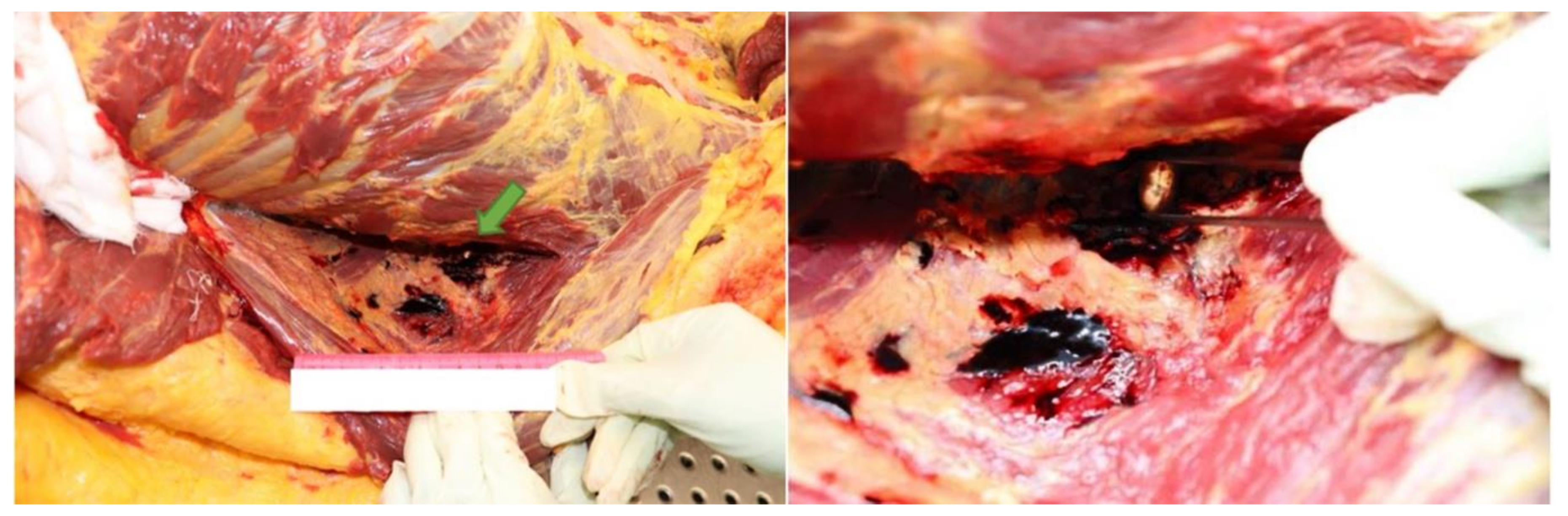 Diagnostics 12 00899 g006