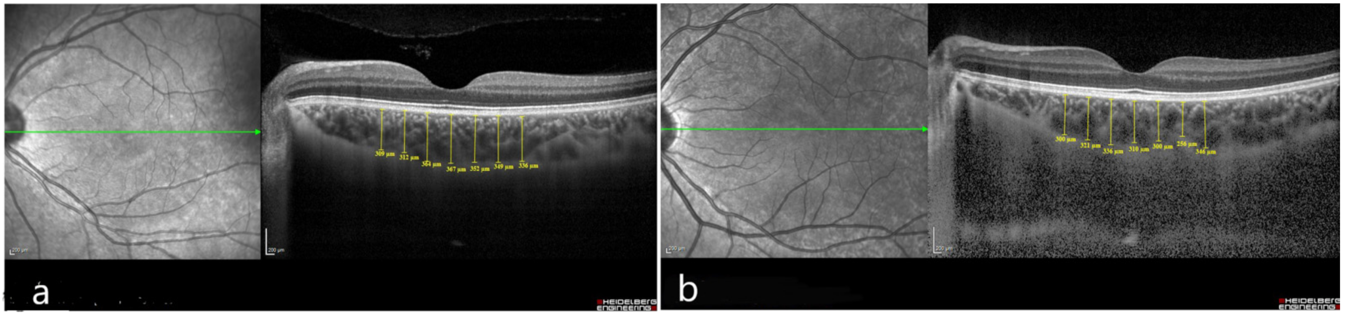 Diagnostics 12 00901 g002