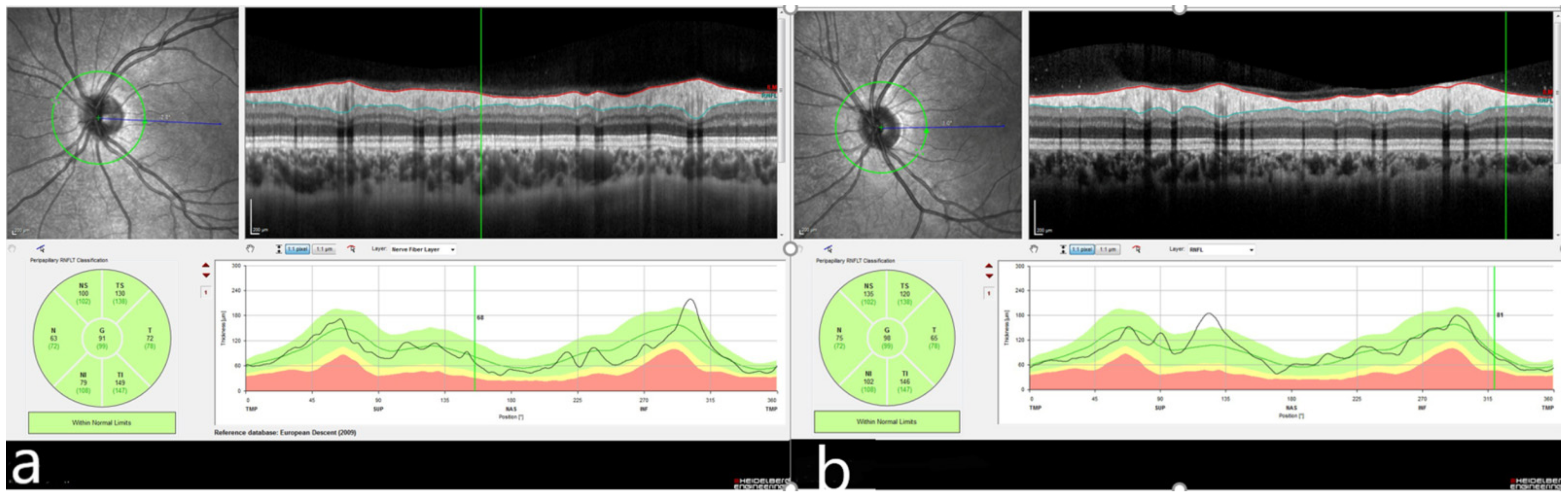 Diagnostics 12 00901 g003