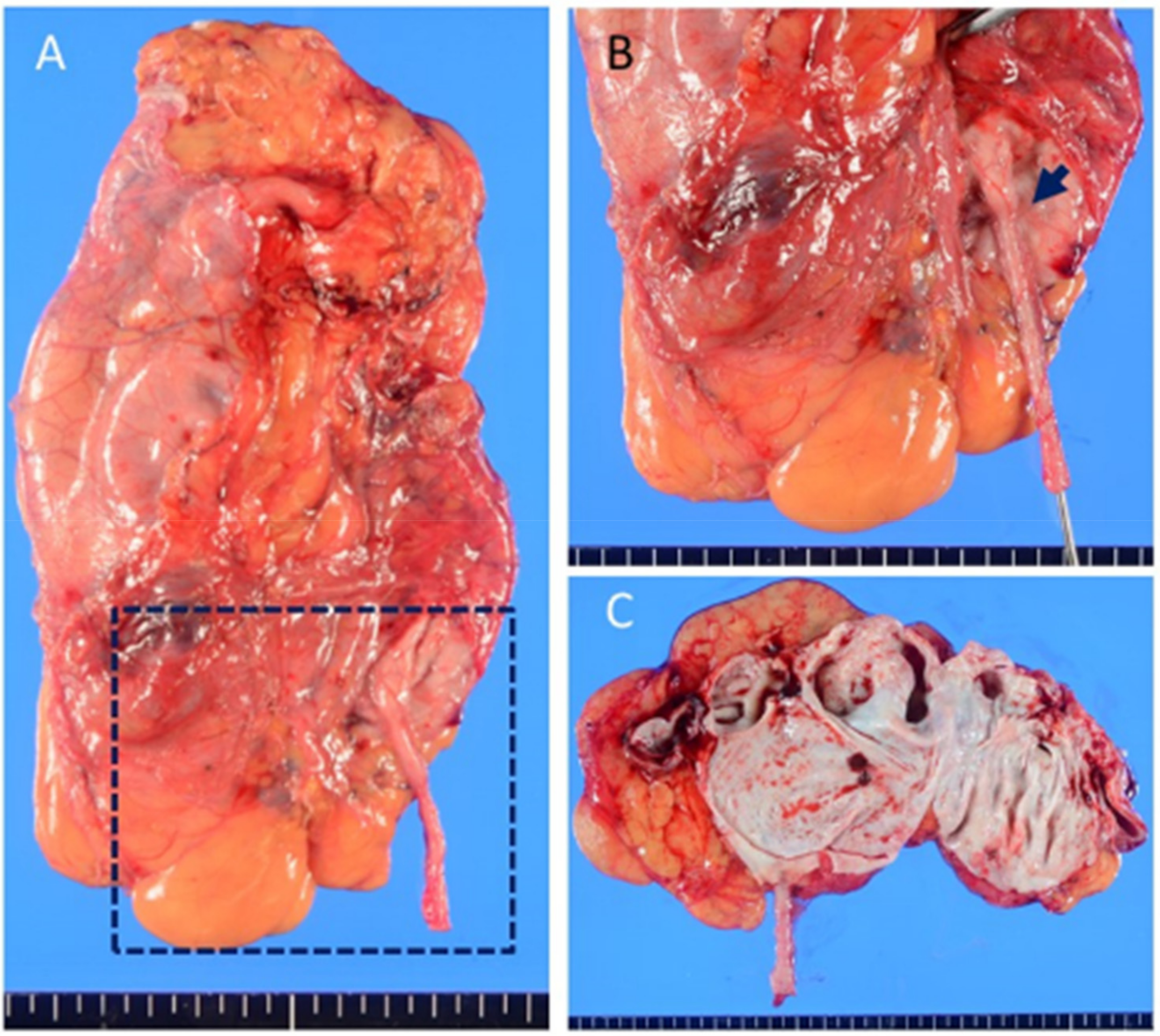 Diagnostics 12 00913 g003