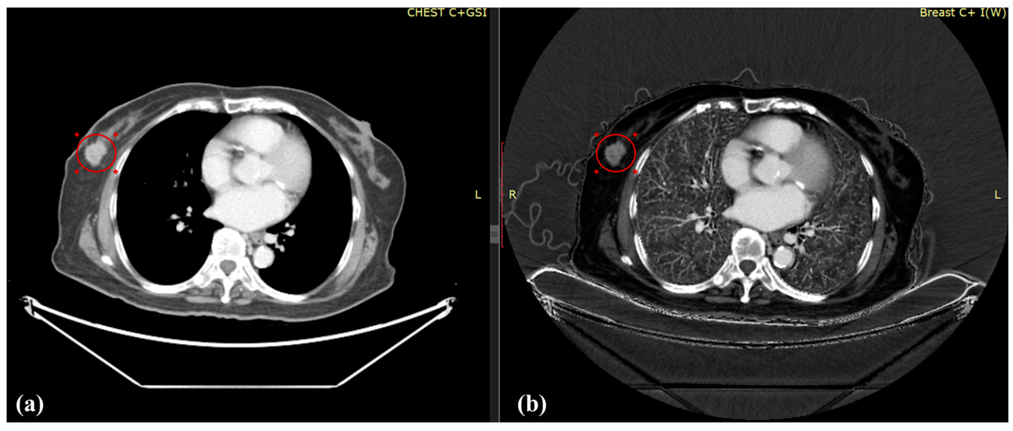 Diagnostics 12 00946 g003