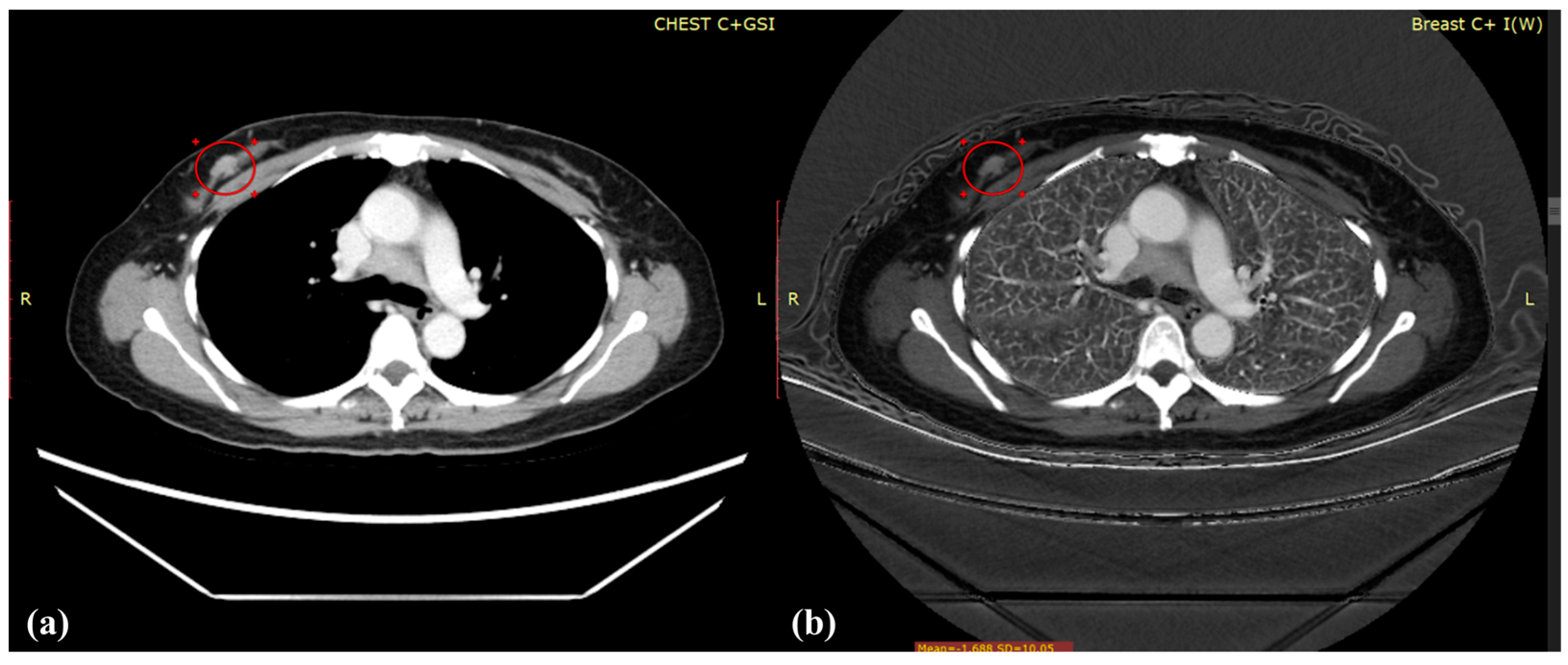 Diagnostics 12 00946 g004