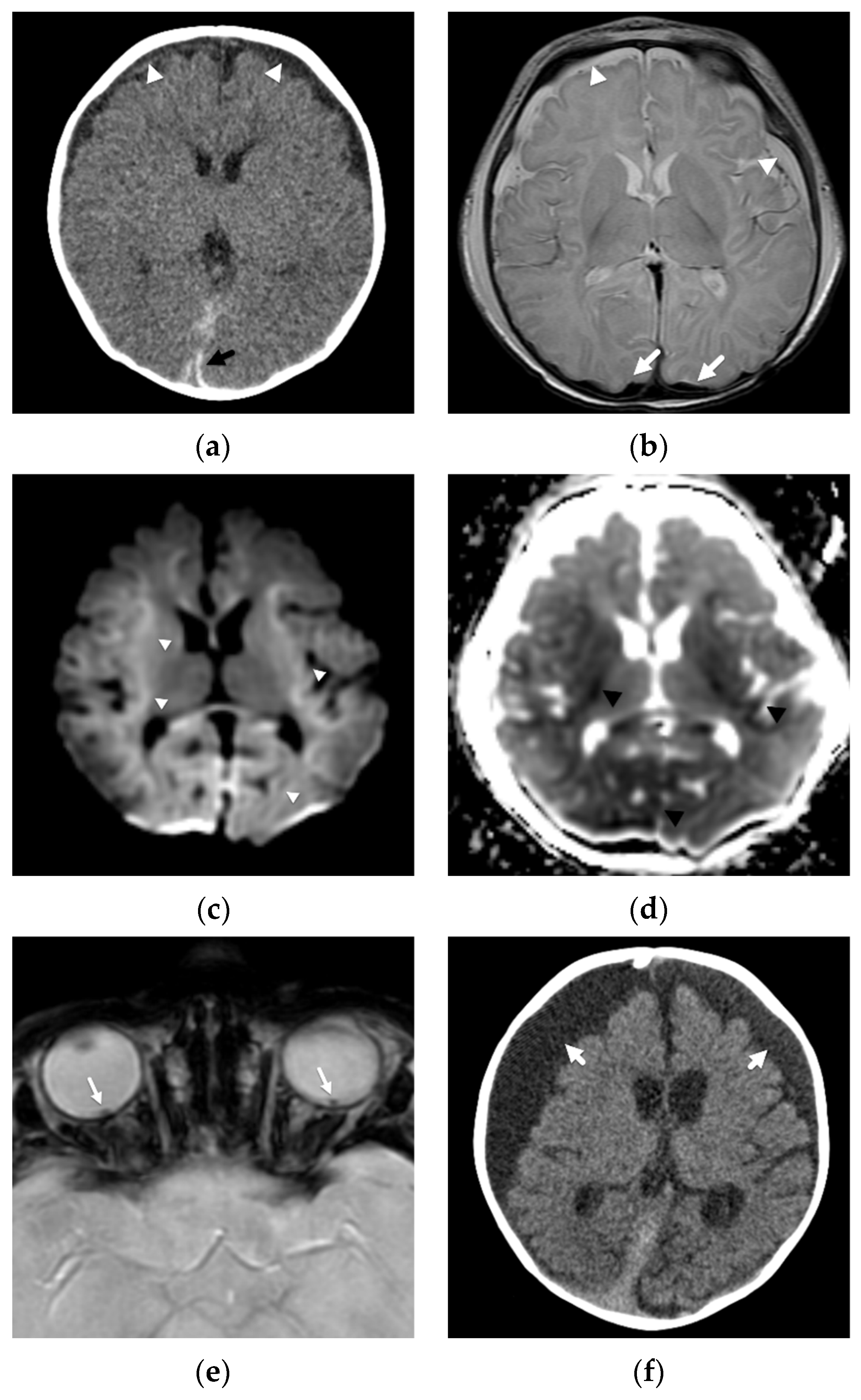 Diagnostics 12 00955 g001