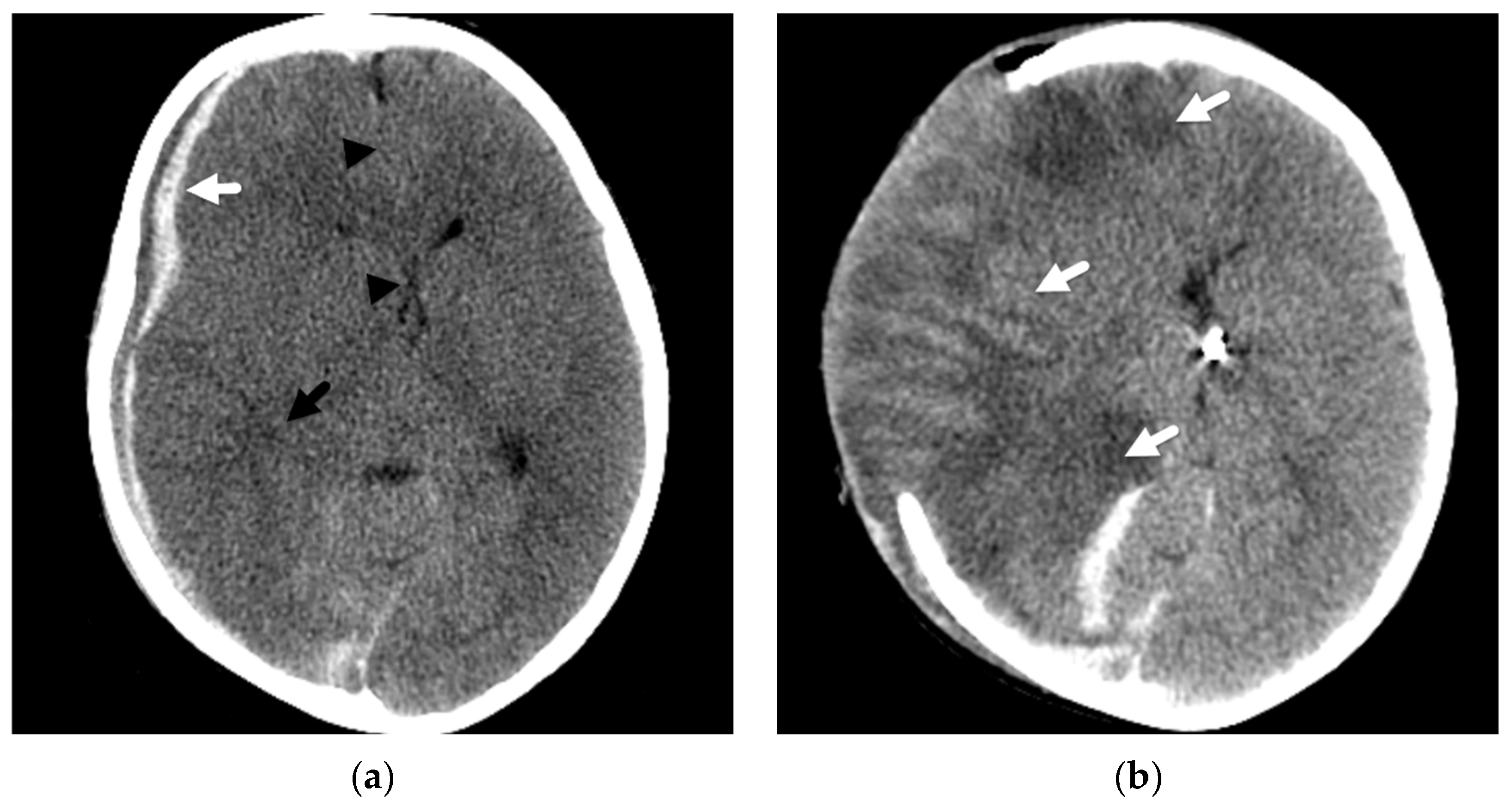 Diagnostics 12 00955 g003