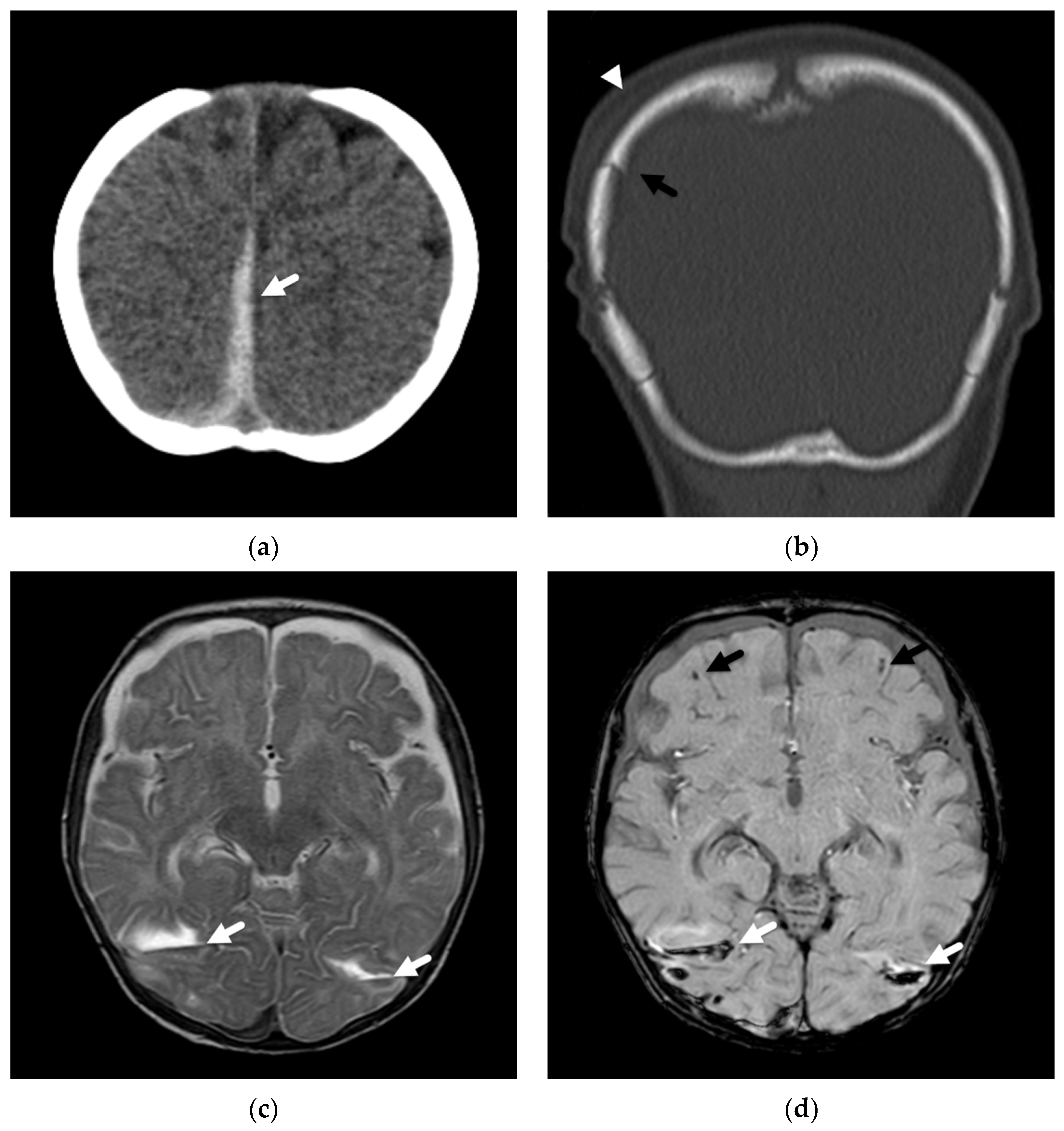 Diagnostics 12 00955 g004