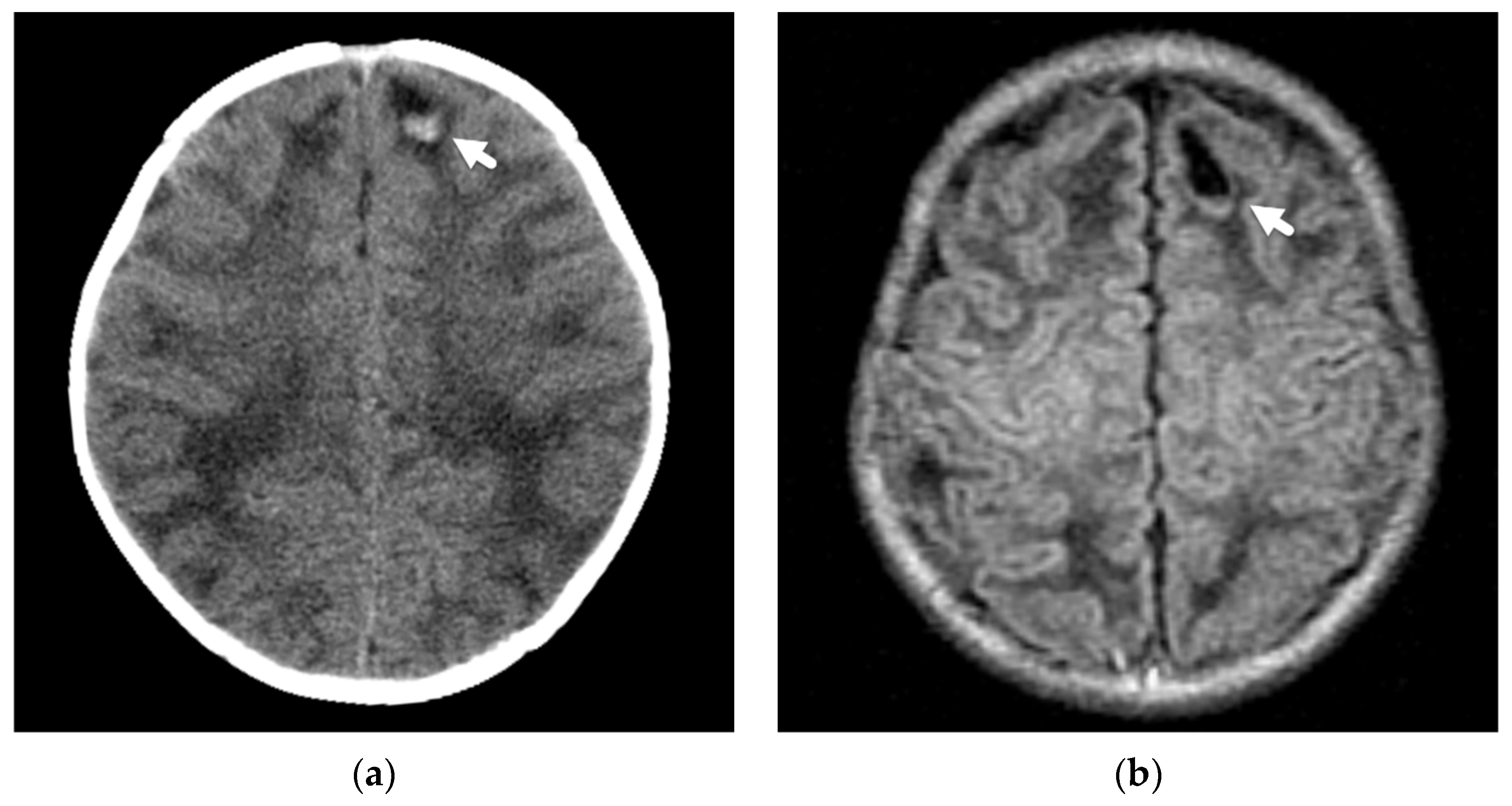Diagnostics 12 00955 g006a