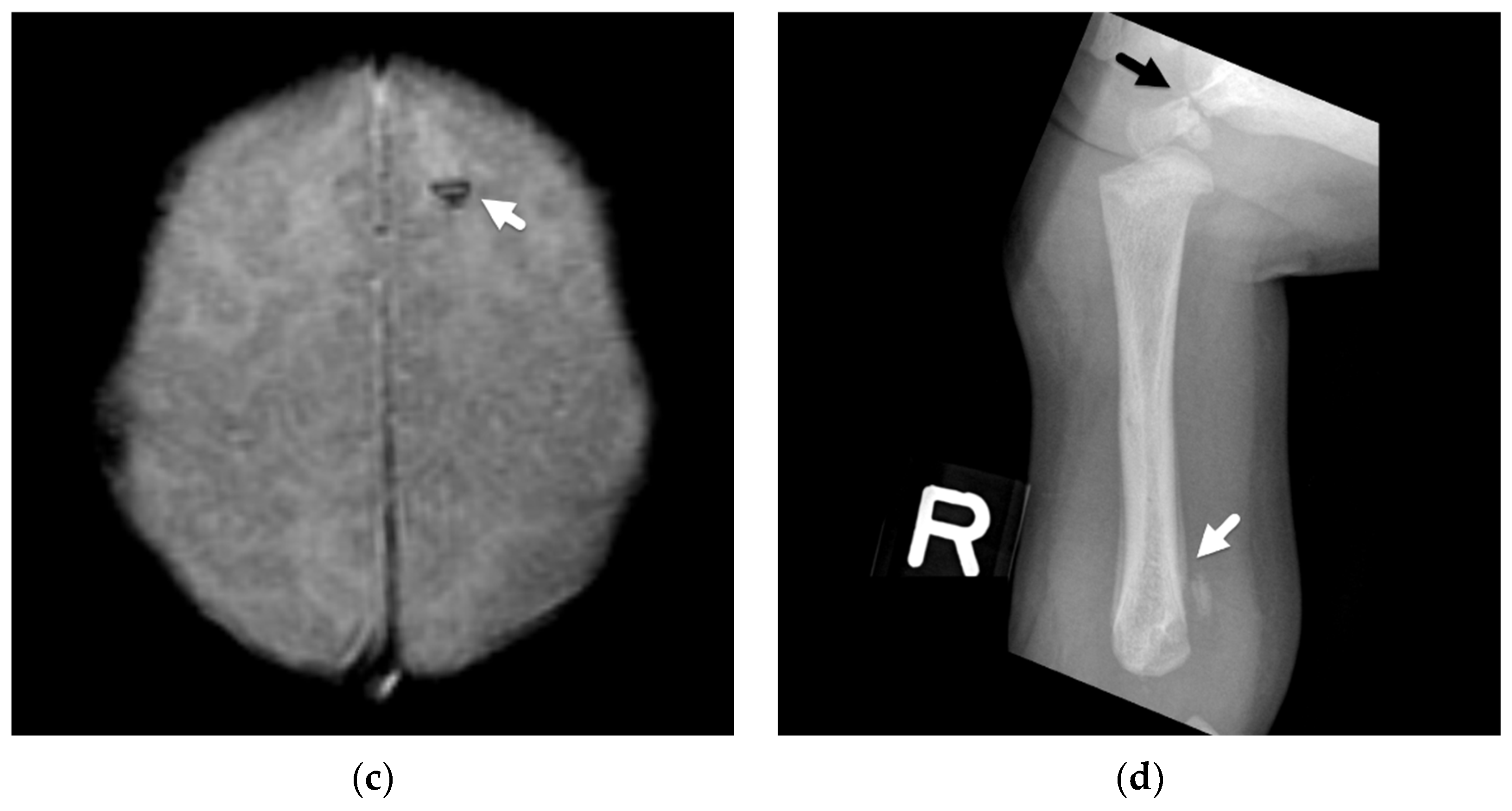 Diagnostics 12 00955 g006b