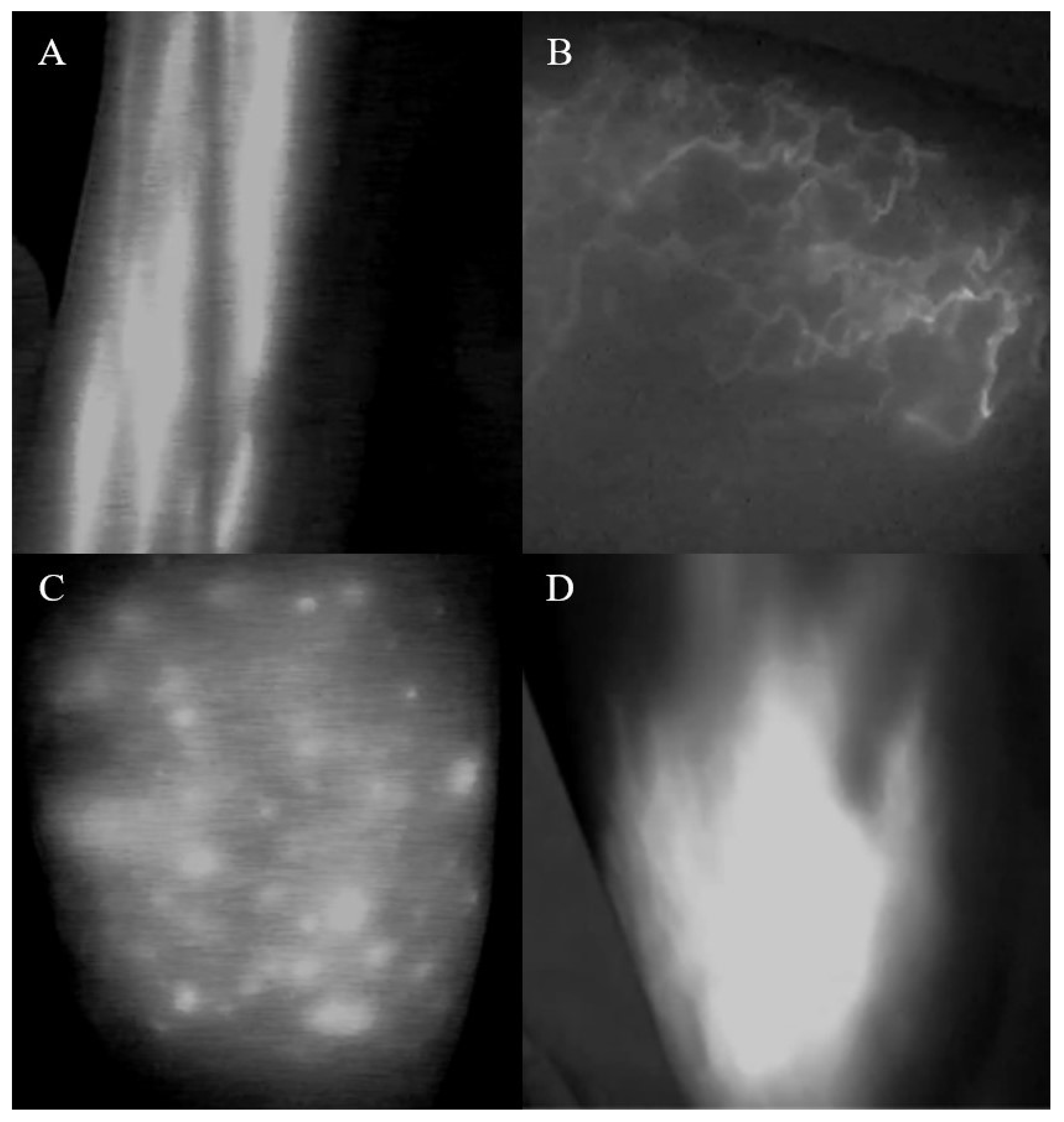 Diagnostics 12 00983 g002