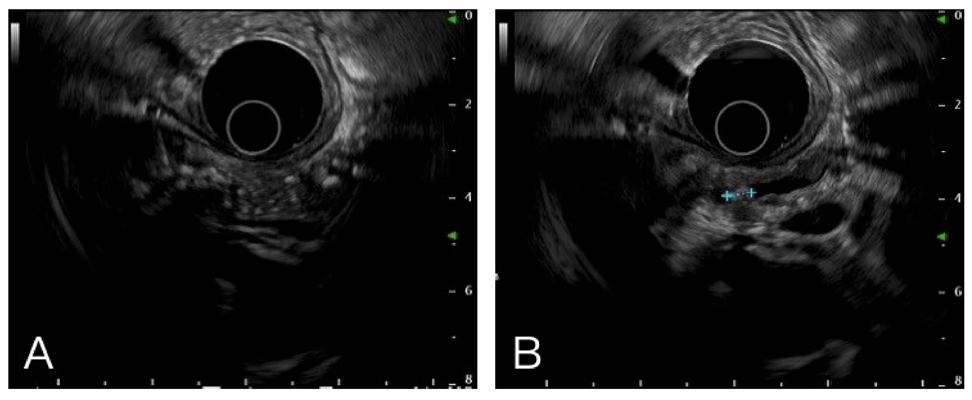 Diagnostics 12 01004 g001