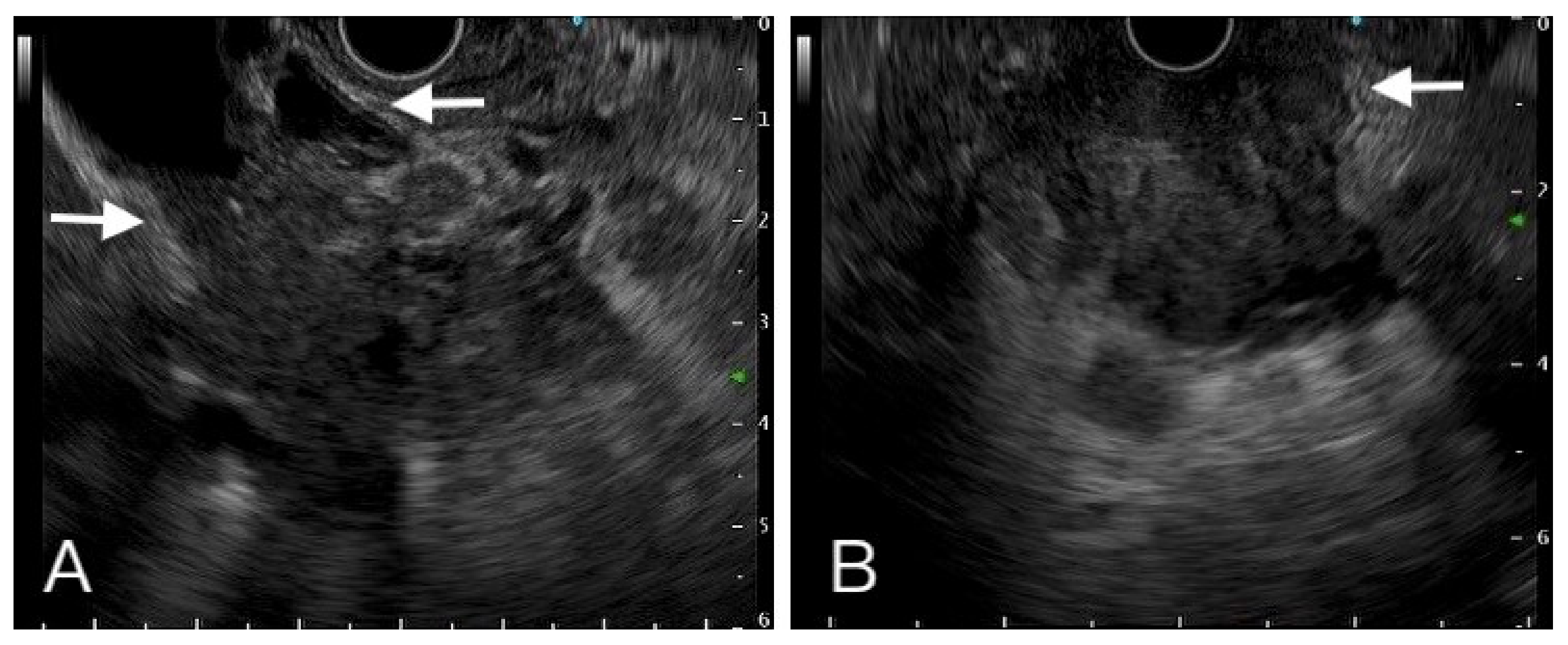 Diagnostics 12 01004 g003