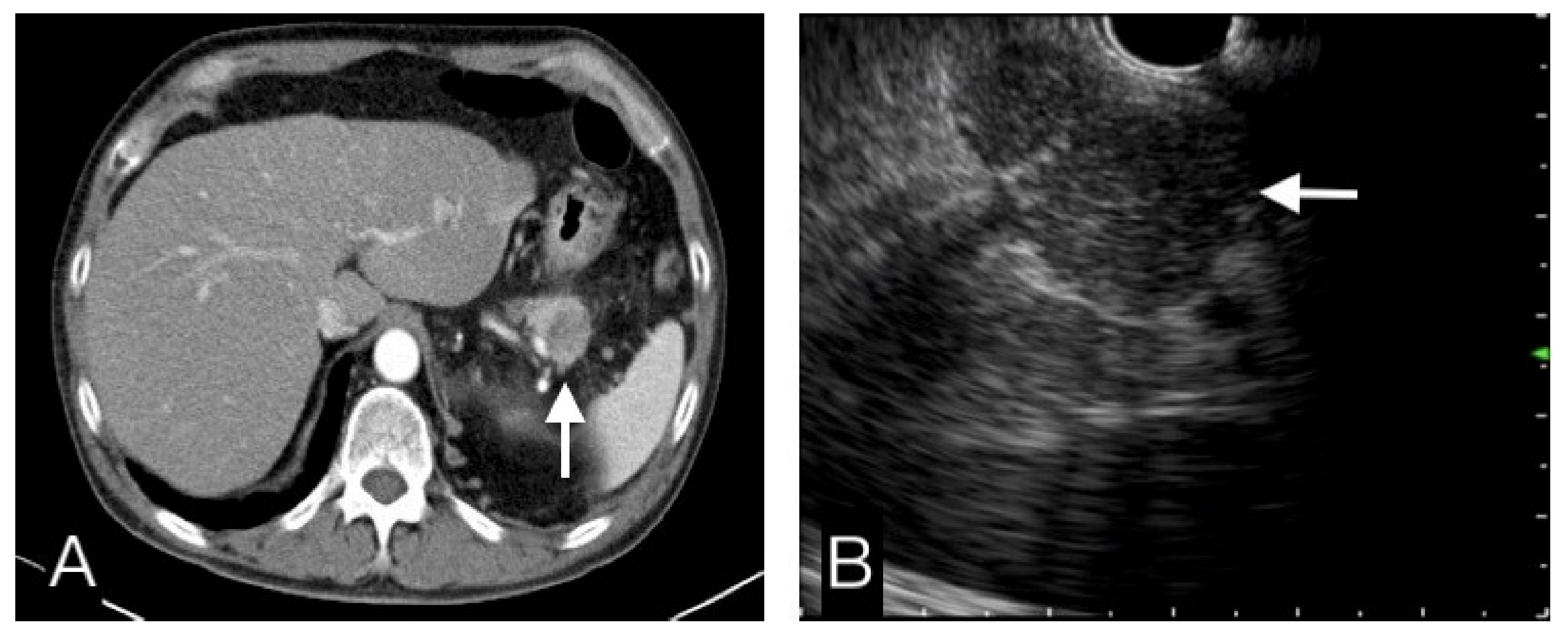 Diagnostics 12 01004 g004