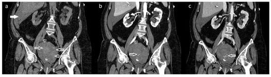 Diagnostics 12 01081 g001 550