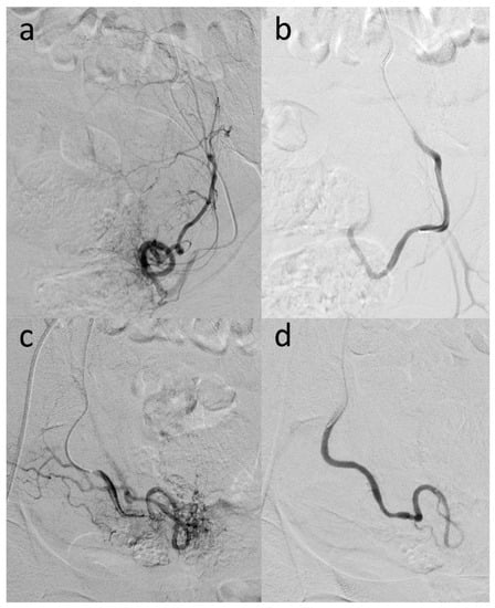 Diagnostics 12 01081 g002 550