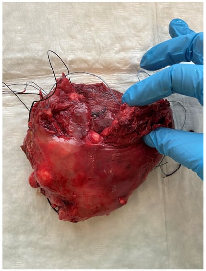 Diagnostics 12 01081 g003 550