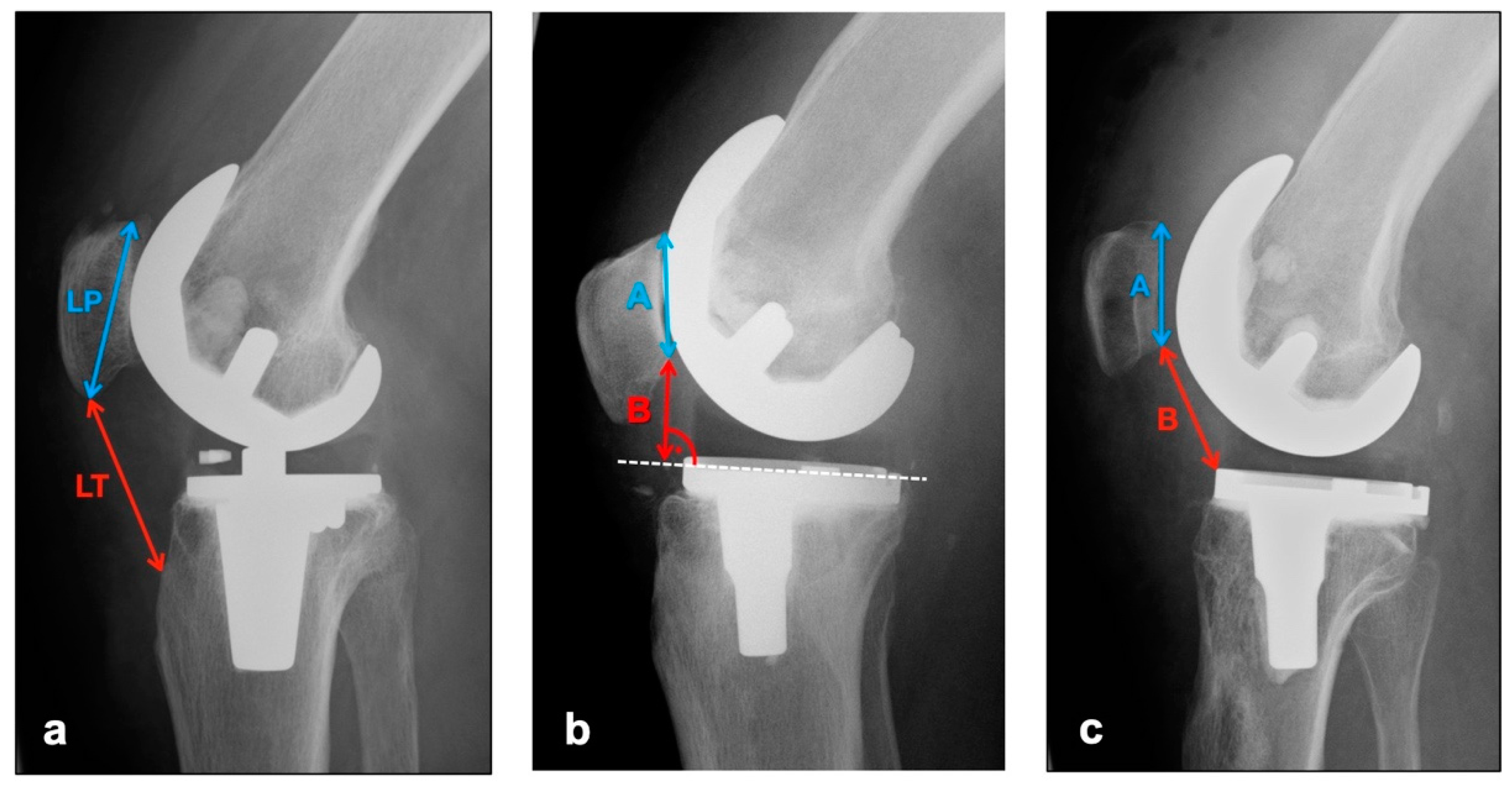 Diagnostics 12 01082 g001