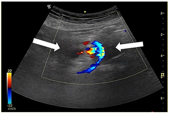 Diagnostics 12 01153 g001