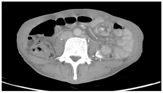 Diagnostics 12 01153 g002