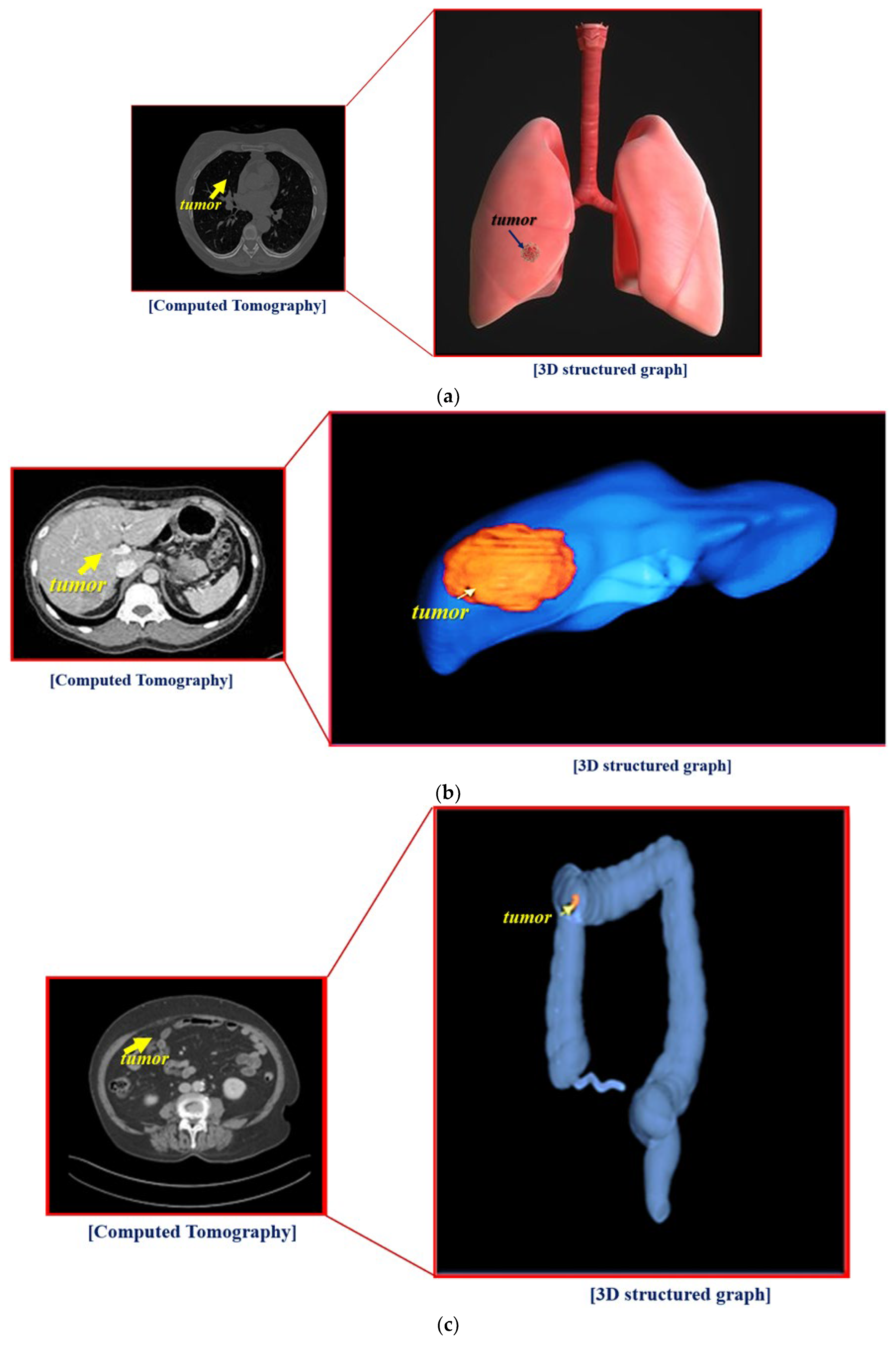 Diagnostics 12 01157 g006