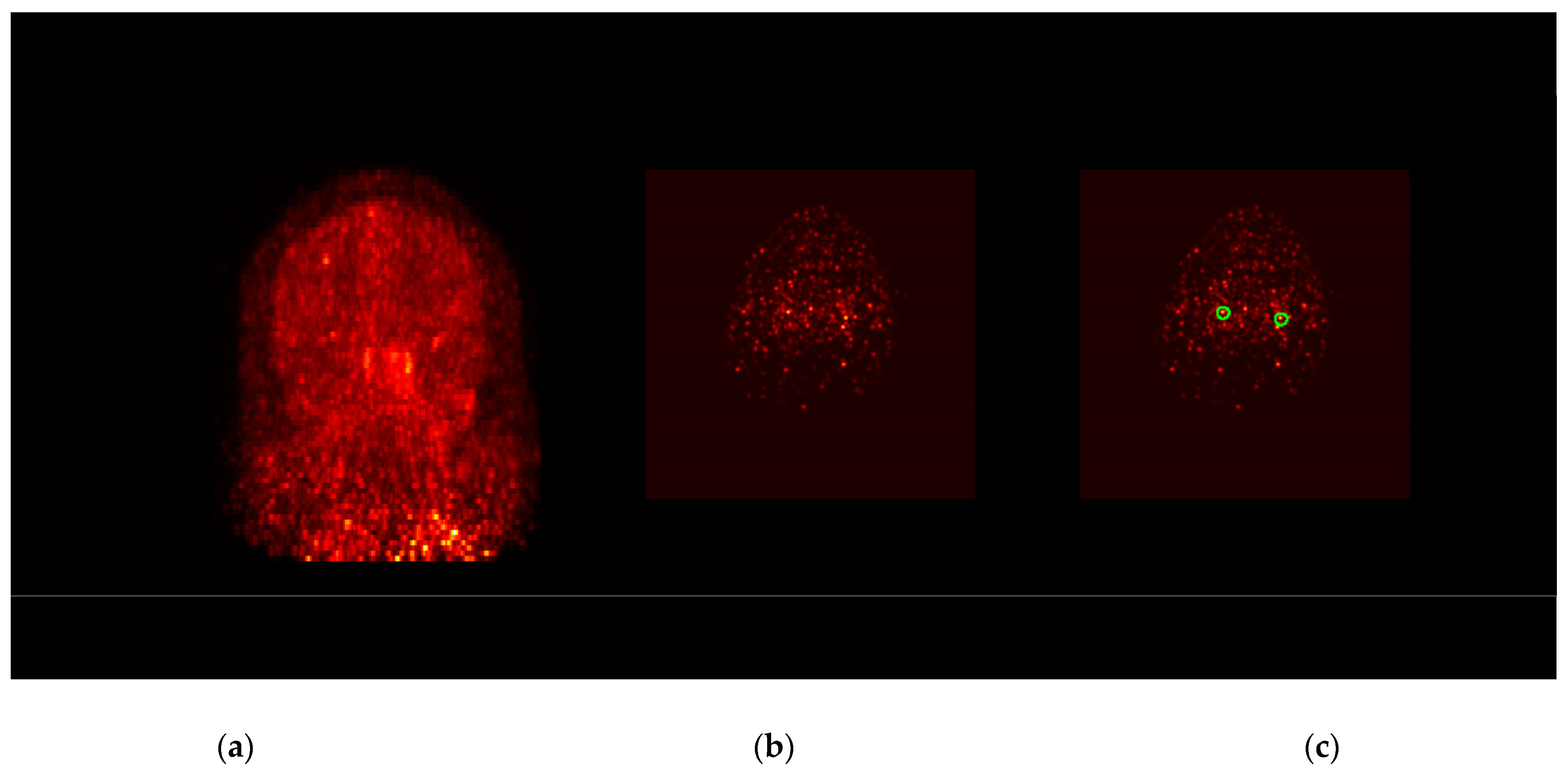 Diagnostics 12 01161 g001a
