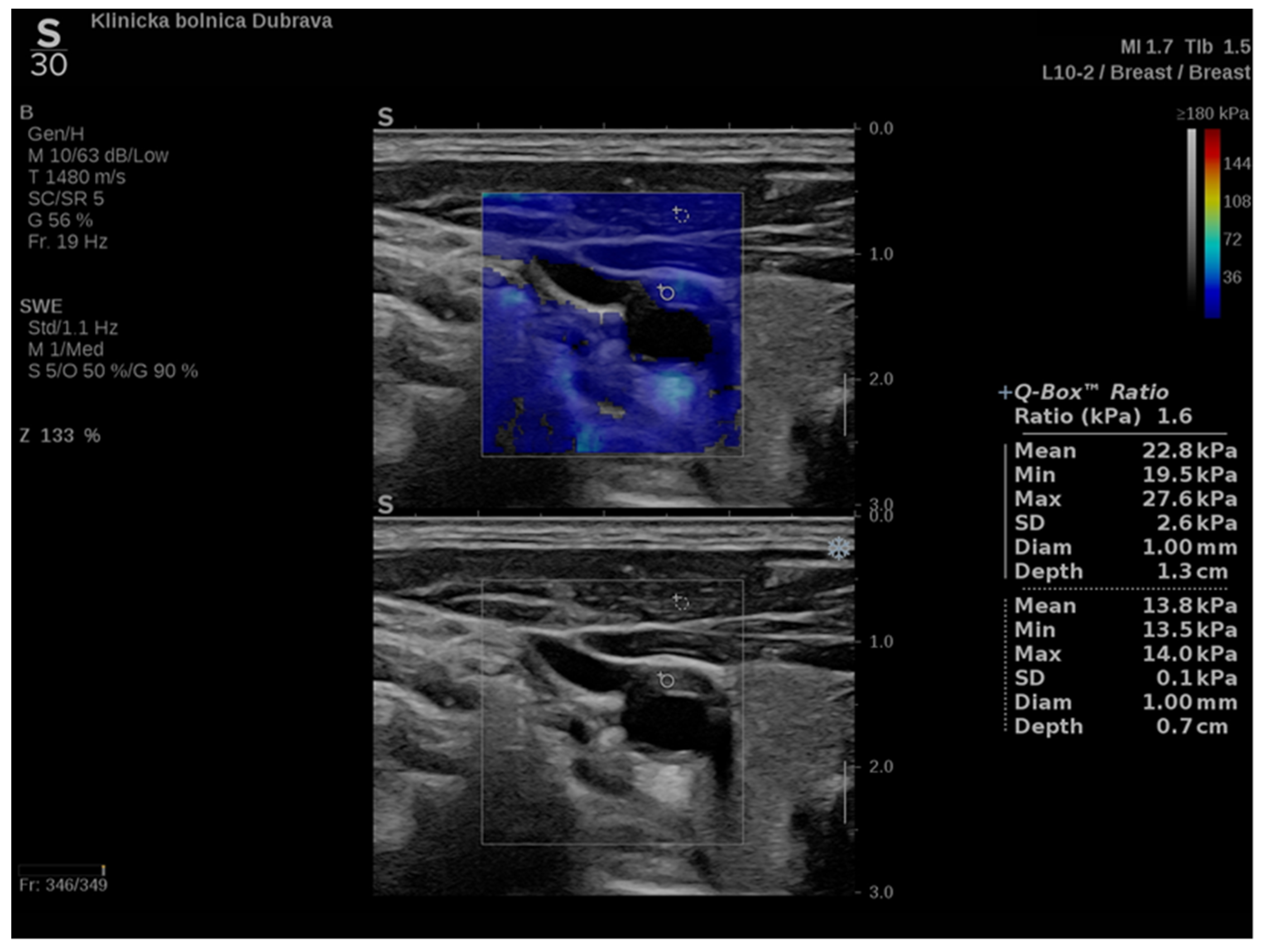 Diagnostics 12 01168 g002