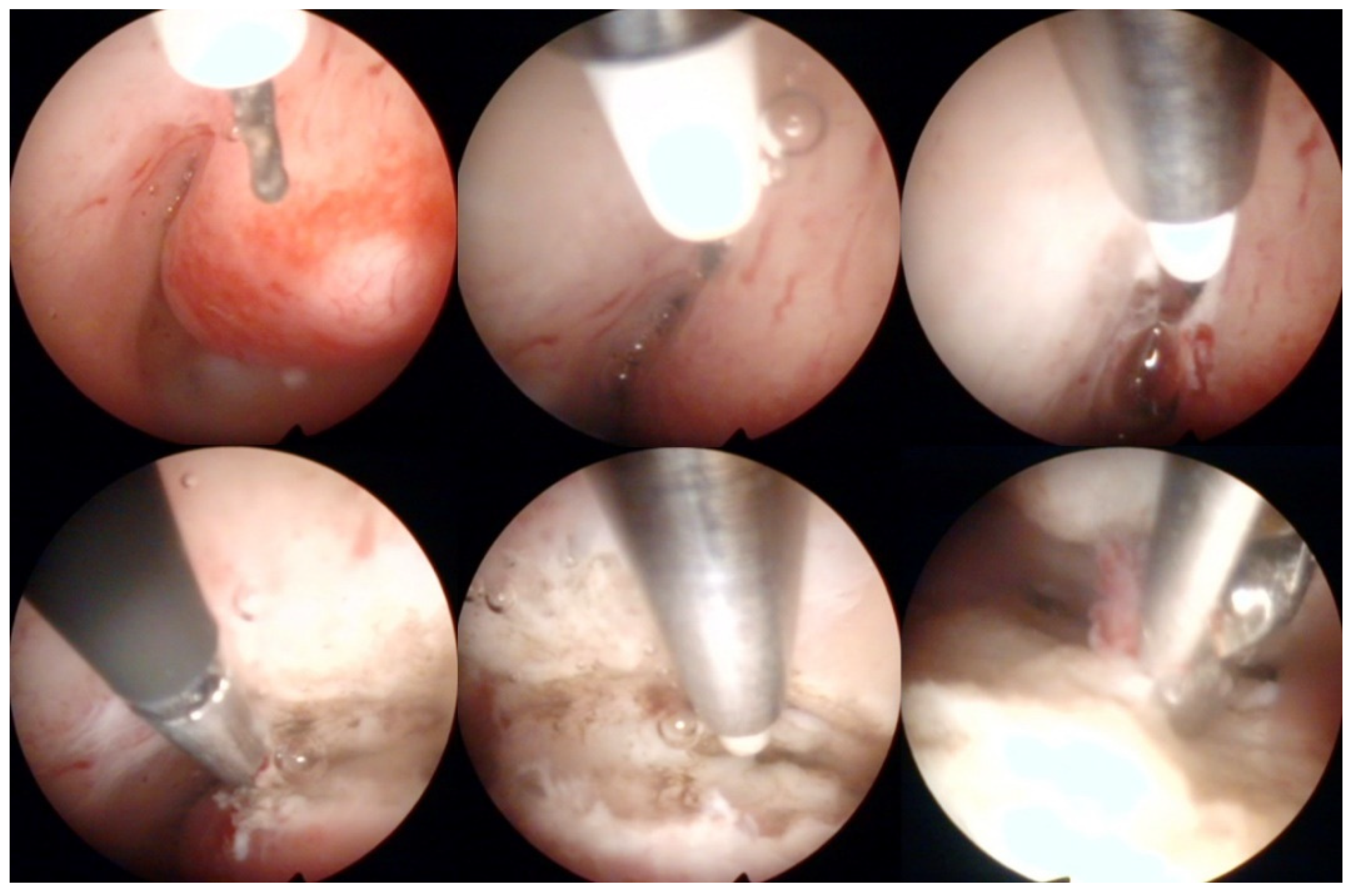 Diagnostics 12 01176 g004 Diagnostics 12 01176 g004