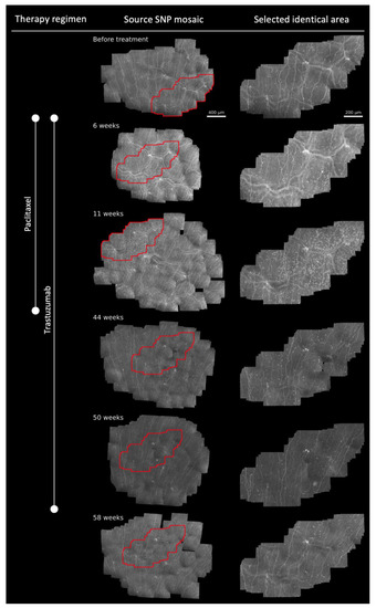Diagnostics 12 01180 g001 550