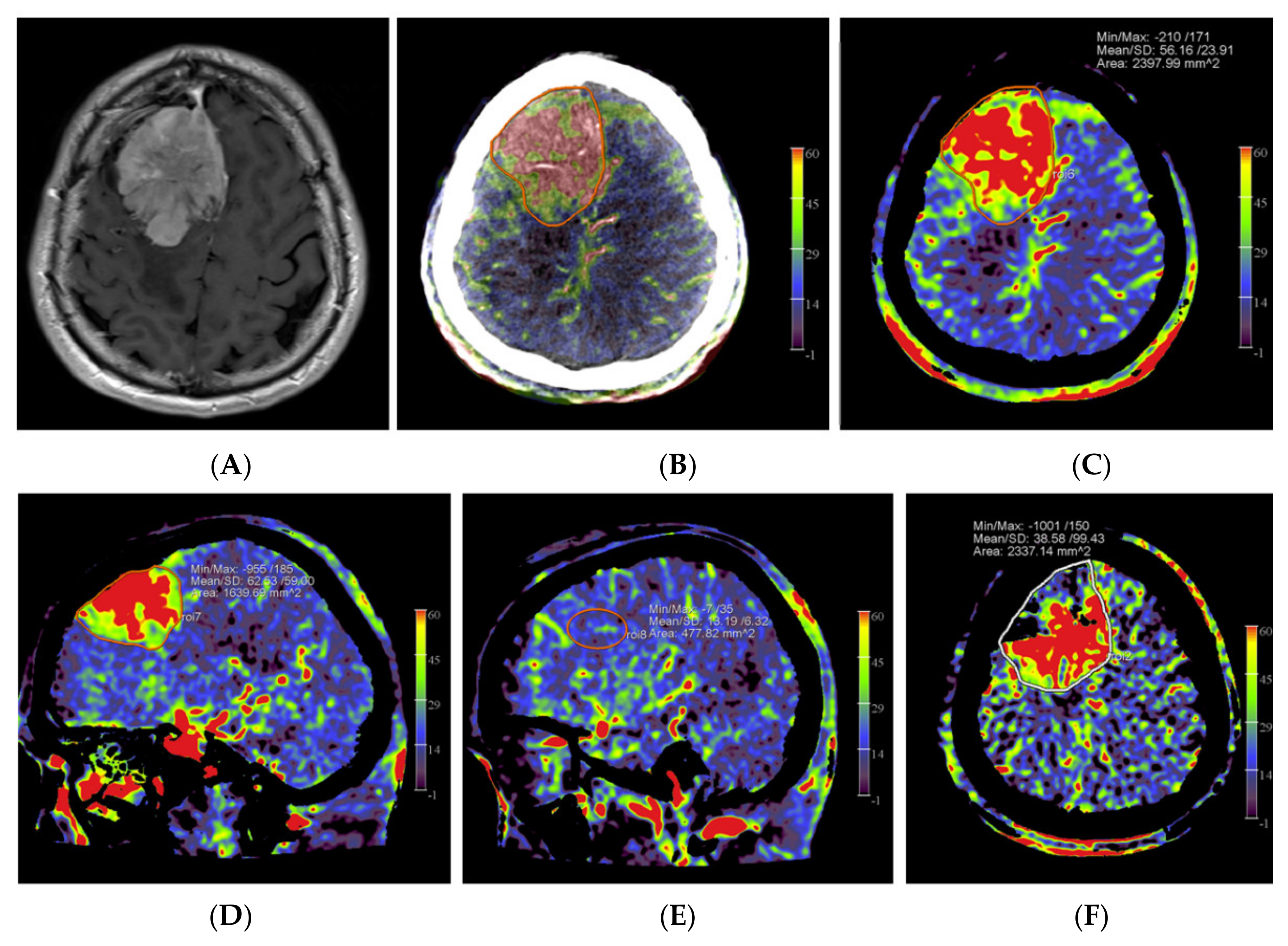 Diagnostics 12 01185 g001