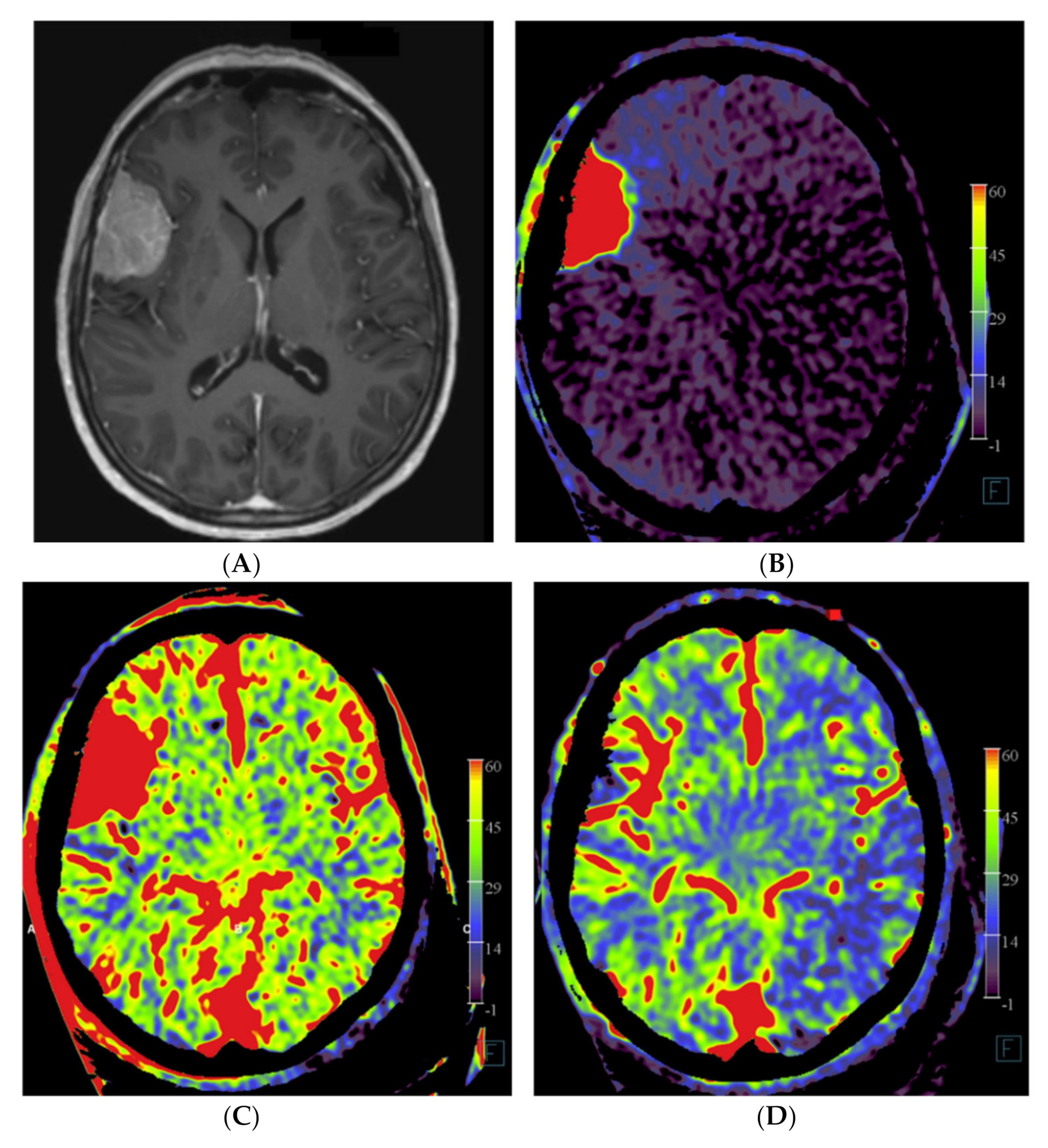 Diagnostics 12 01185 g002