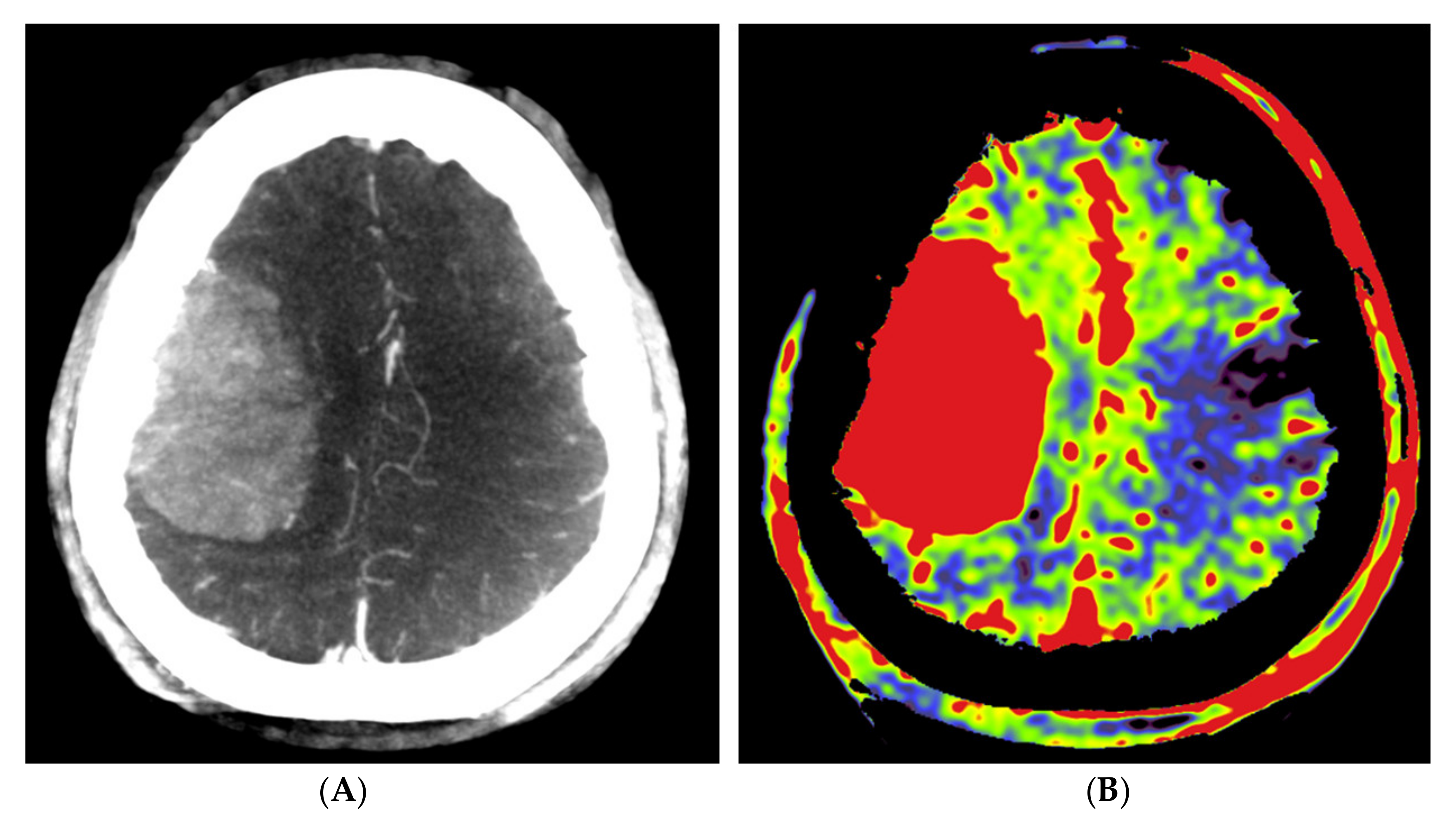 Diagnostics 12 01185 g004a