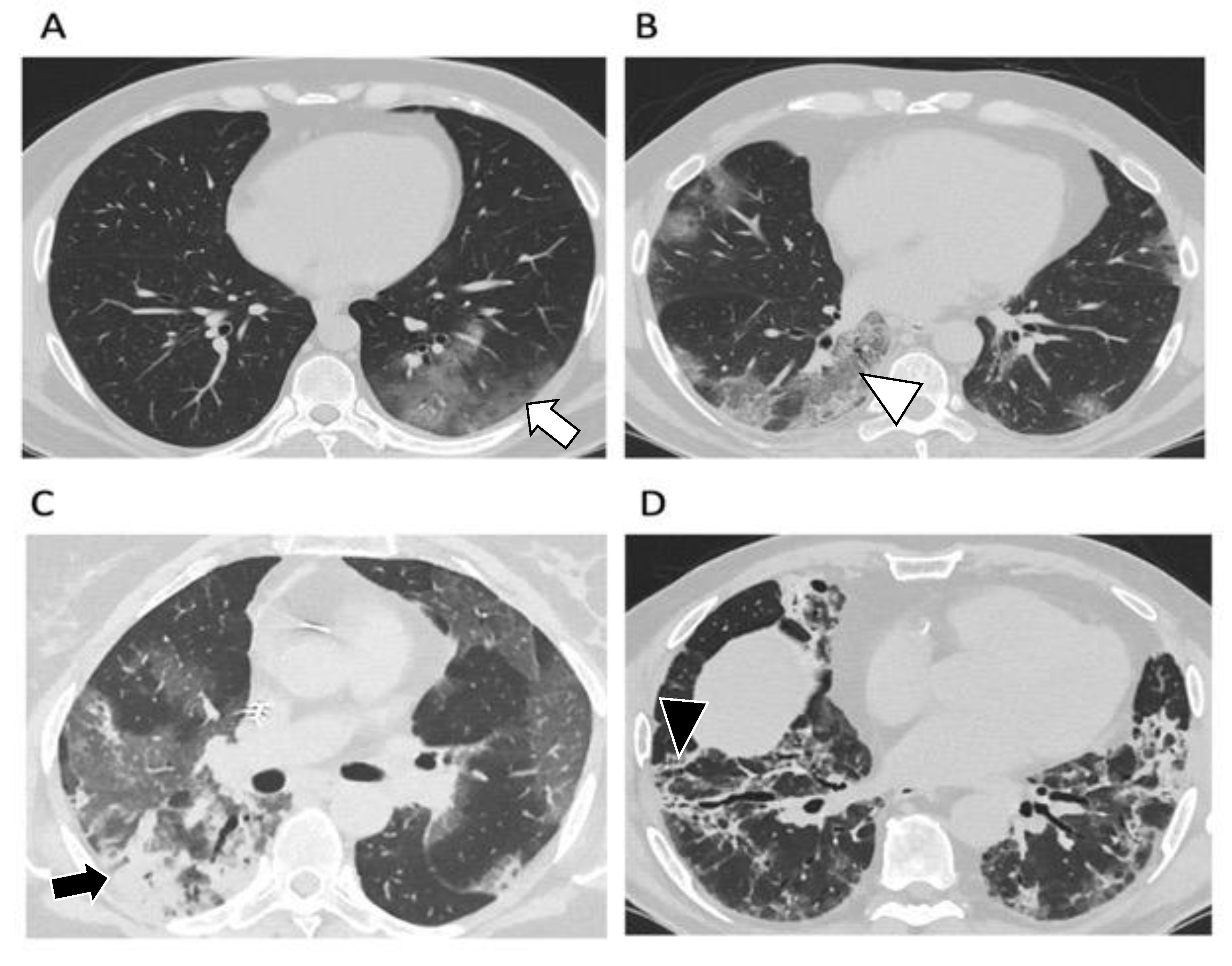 Diagnostics 12 01188 g002