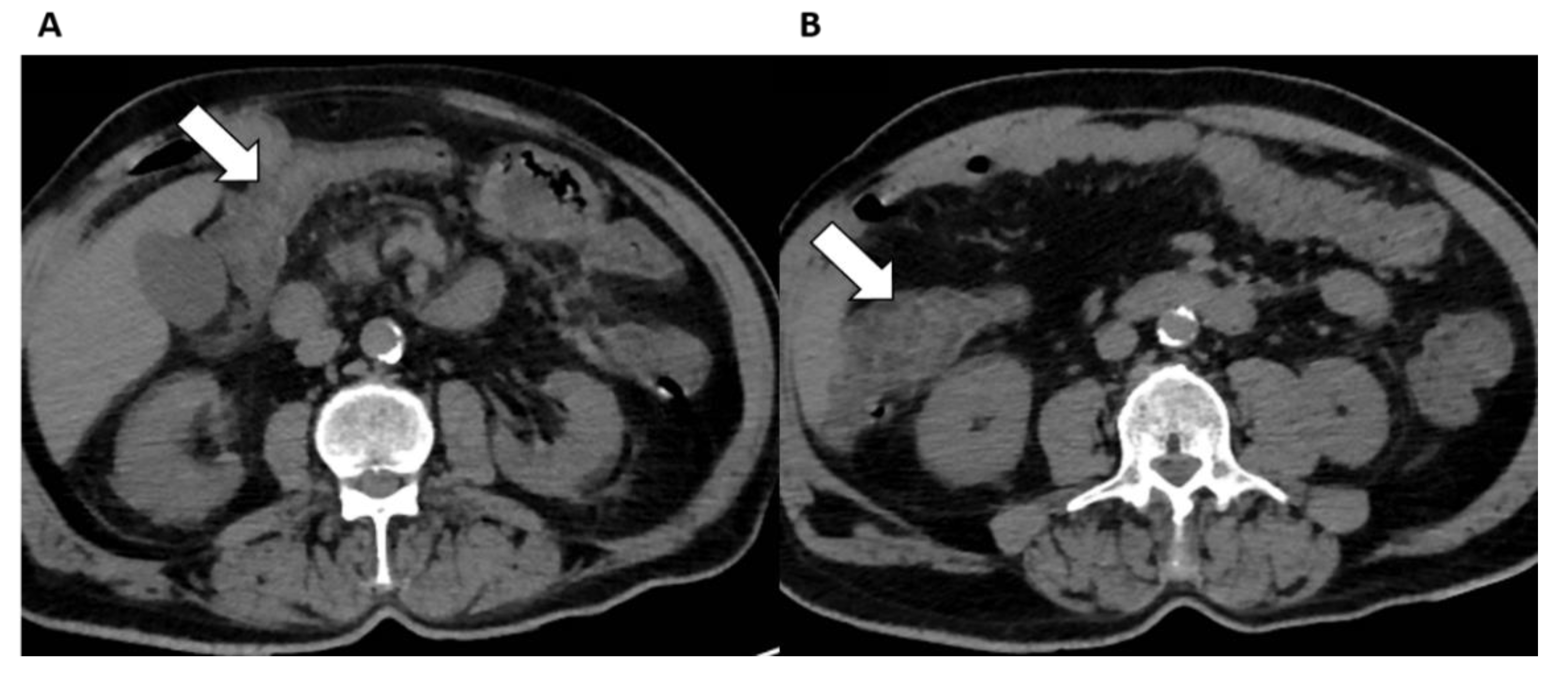 Diagnostics 12 01188 g005