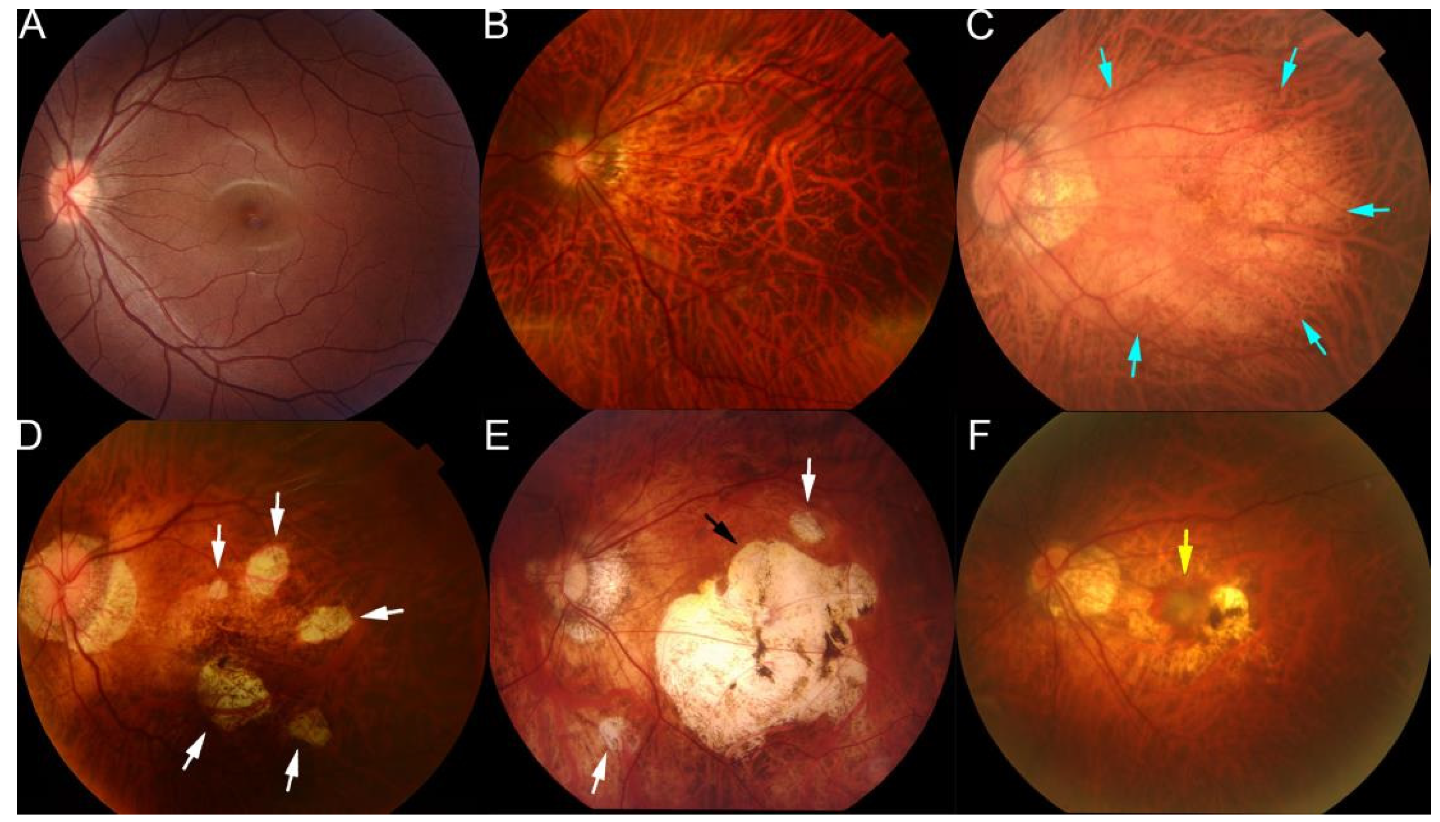 Diagnostics 12 01210 g002 Diagnostics 12 01210 g002