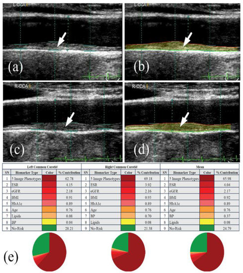 Diagnostics 12 01234 g010
