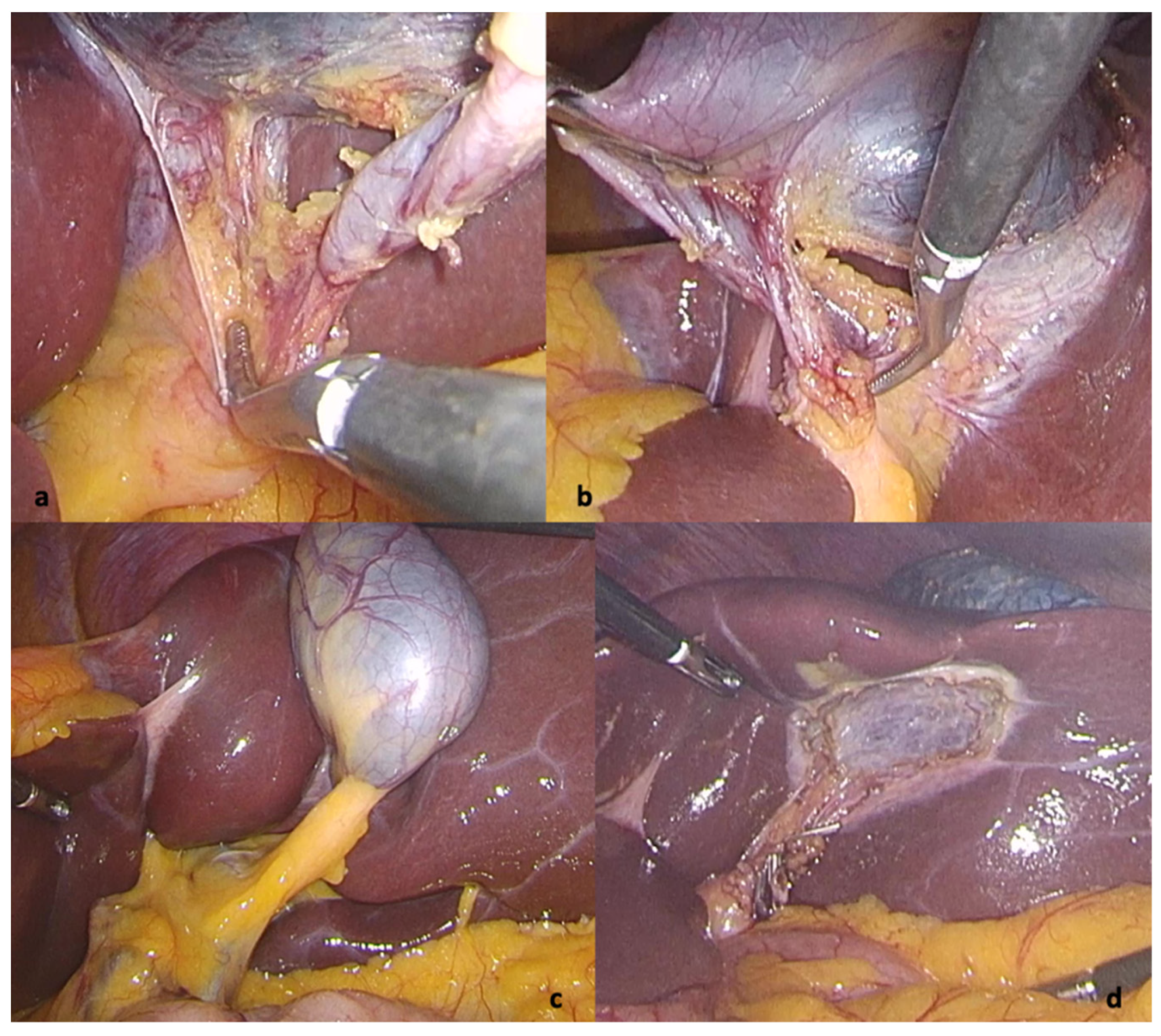 Diagnostics 12 01265 g003 Diagnostics 12 01265 g003