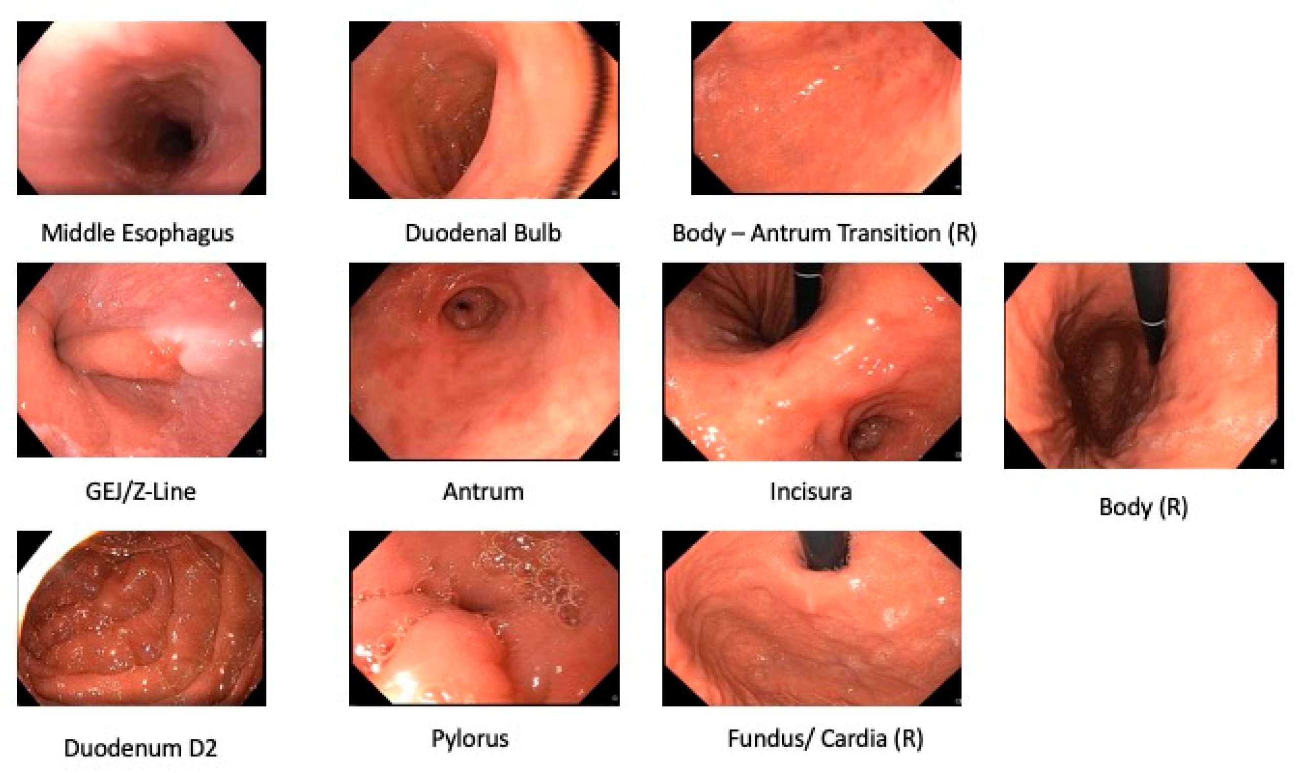 Diagnostics 12 01278 g001