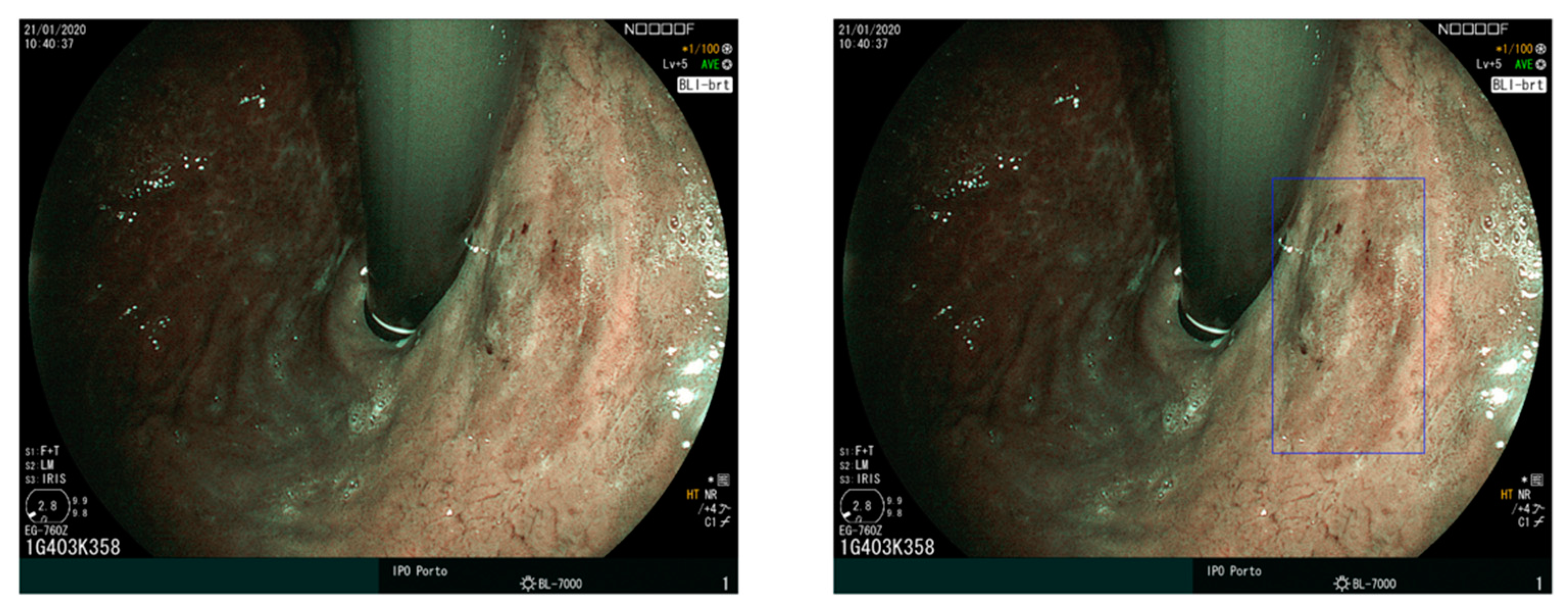 Diagnostics 12 01278 g005