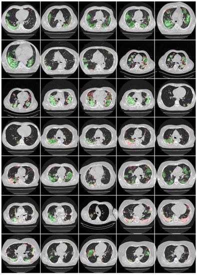 Diagnostics 12 01283 g0a2