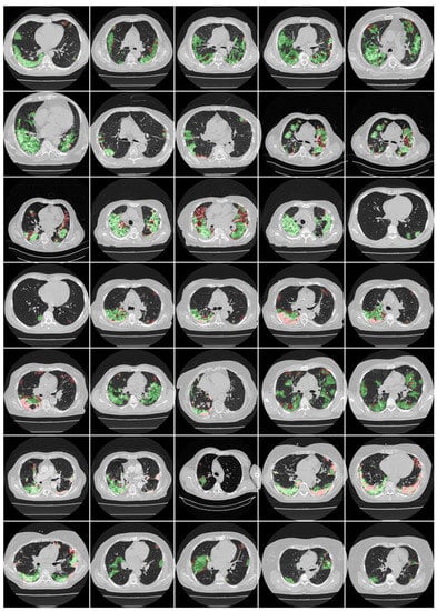 Diagnostics 12 01283 g0a4