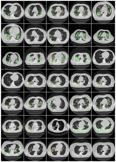 Diagnostics 12 01283 g0a6