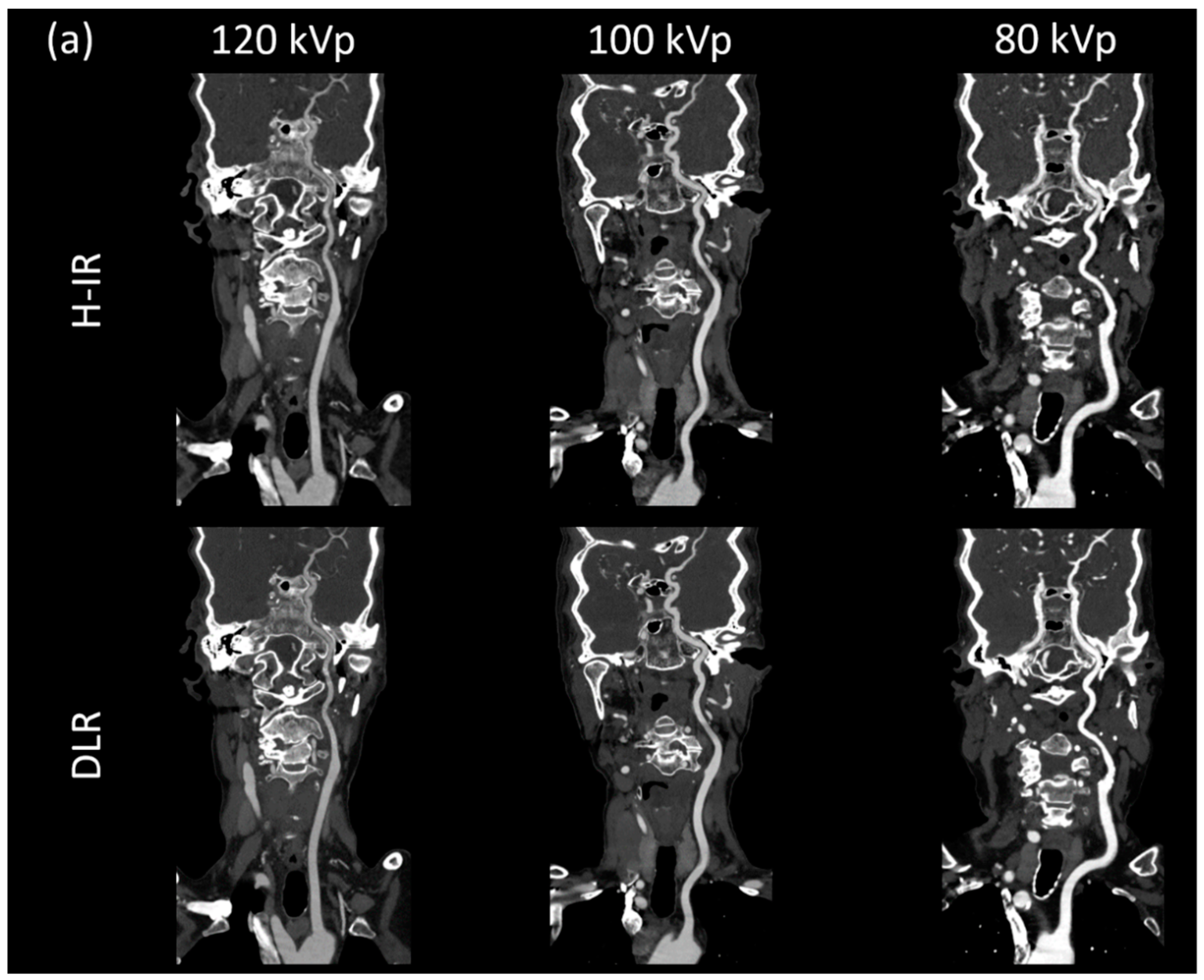 Diagnostics 12 01287 g003a