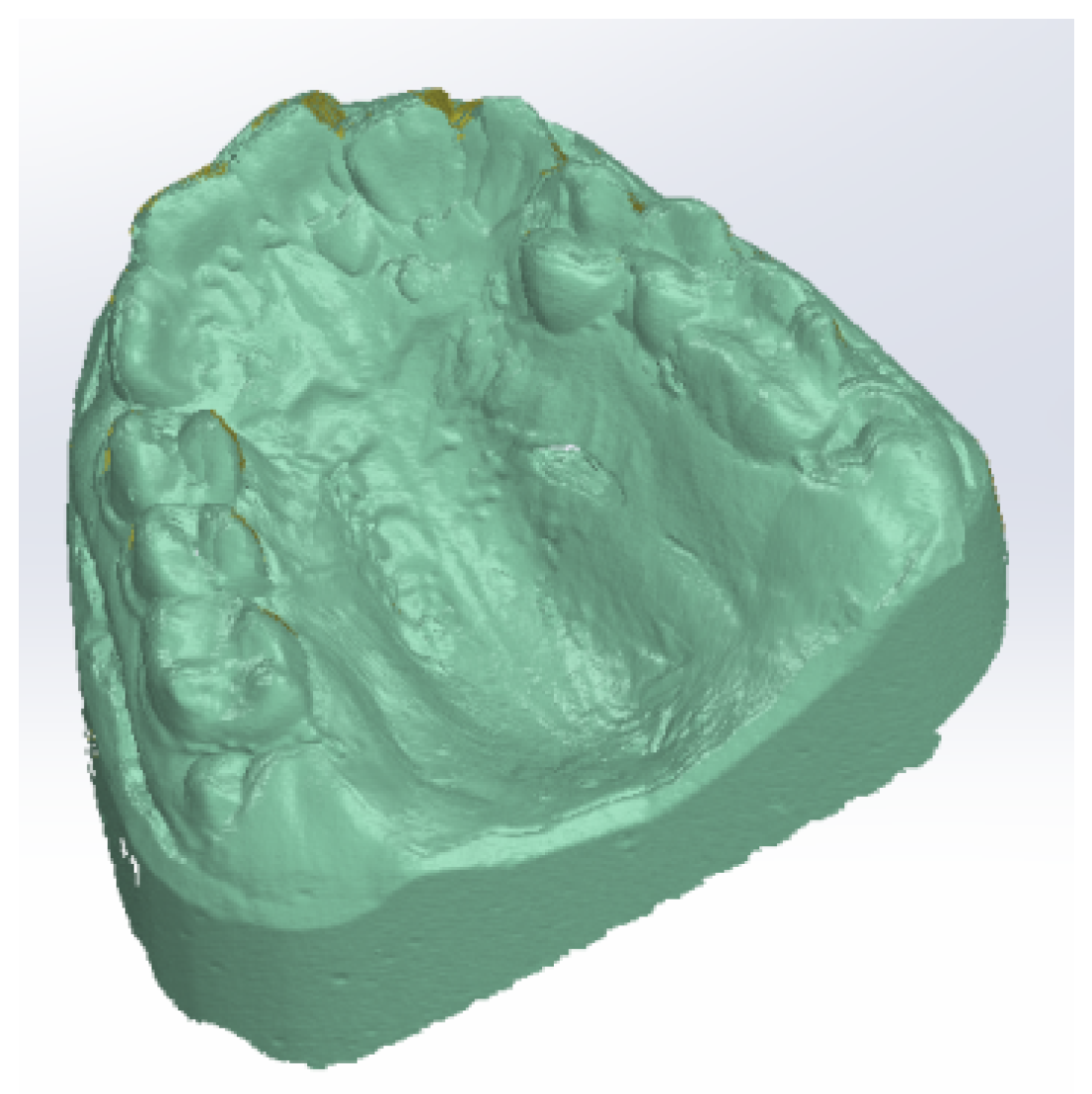 Diagnostics 12 01296 g005