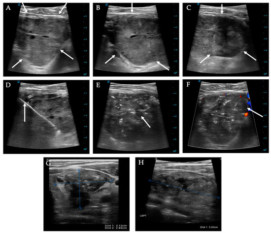 Diagnostics 12 01300 g013 550