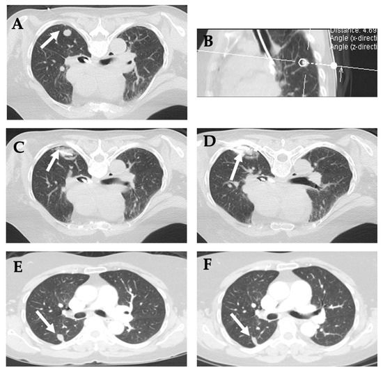 Diagnostics 12 01300 g016 550