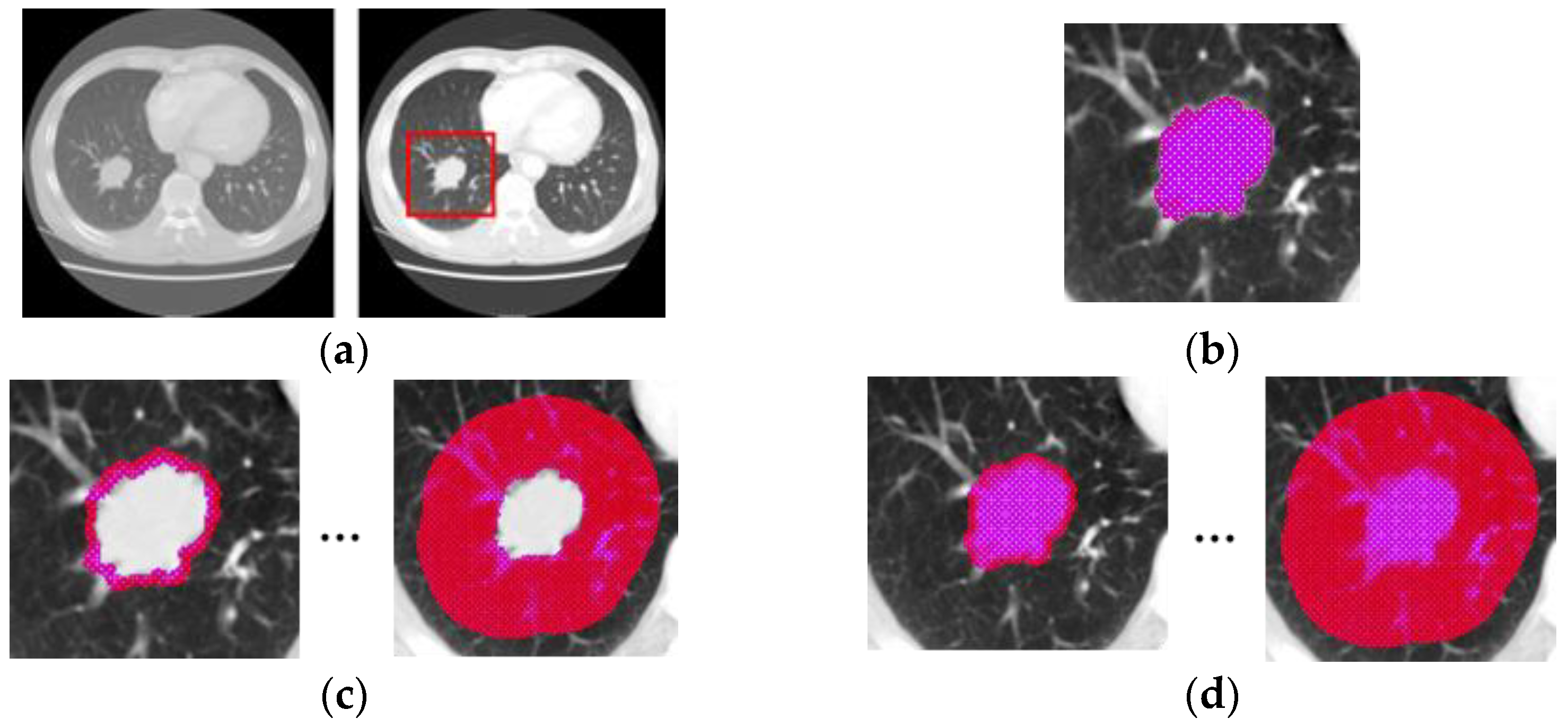 Diagnostics 12 01313 g004