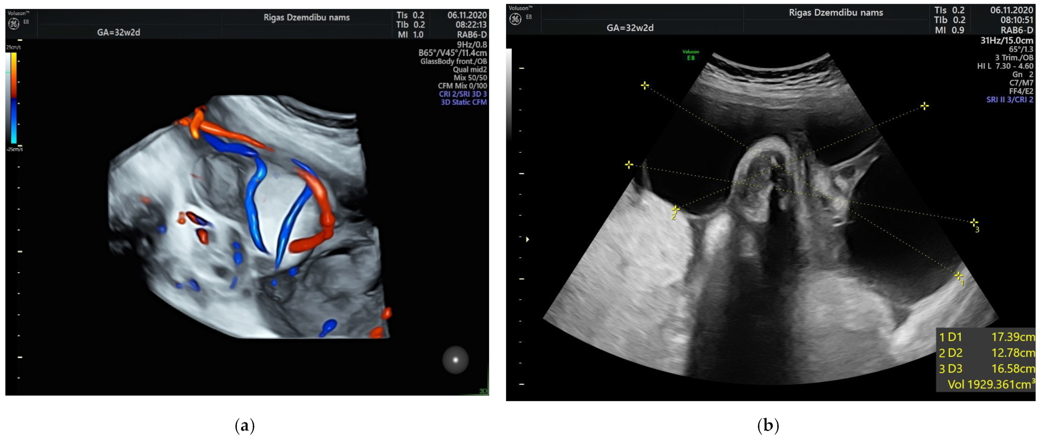 Diagnostics 12 01339 g002