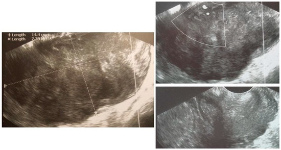 Diagnostics 12 01348 g0a2 550