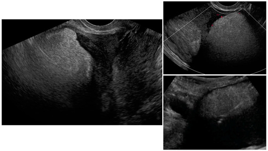 Diagnostics 12 01348 g0a3 550