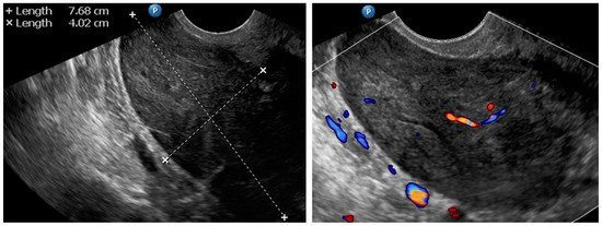 Diagnostics 12 01348 g0a4 550